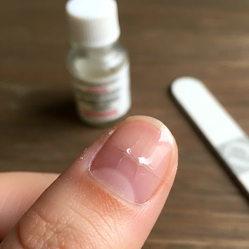 How to Fix Cracked Nail