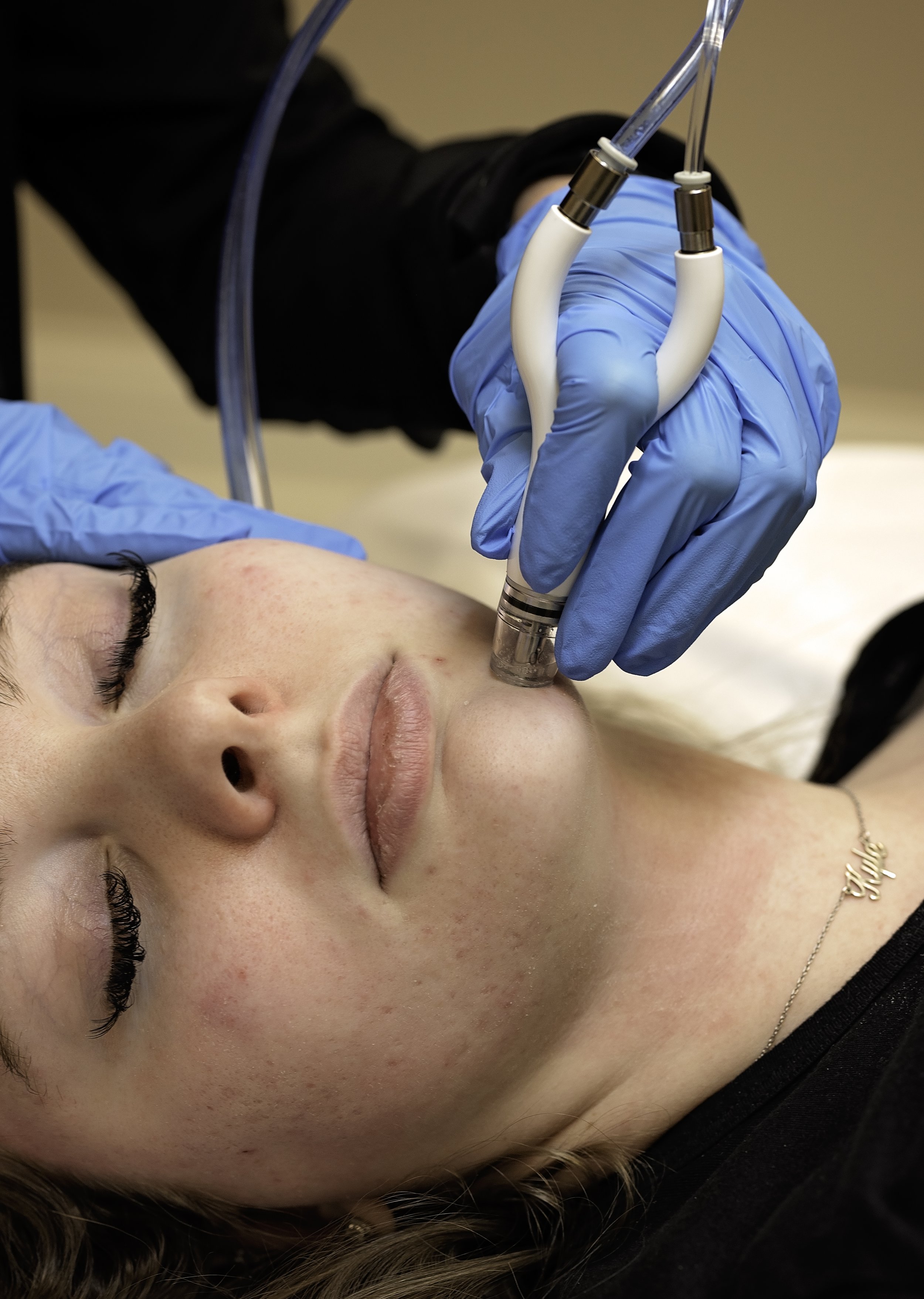 How to Prepare Your Skin for a Big Event: The Ultimate Timeline for Glowing, Camera-Ready Skin