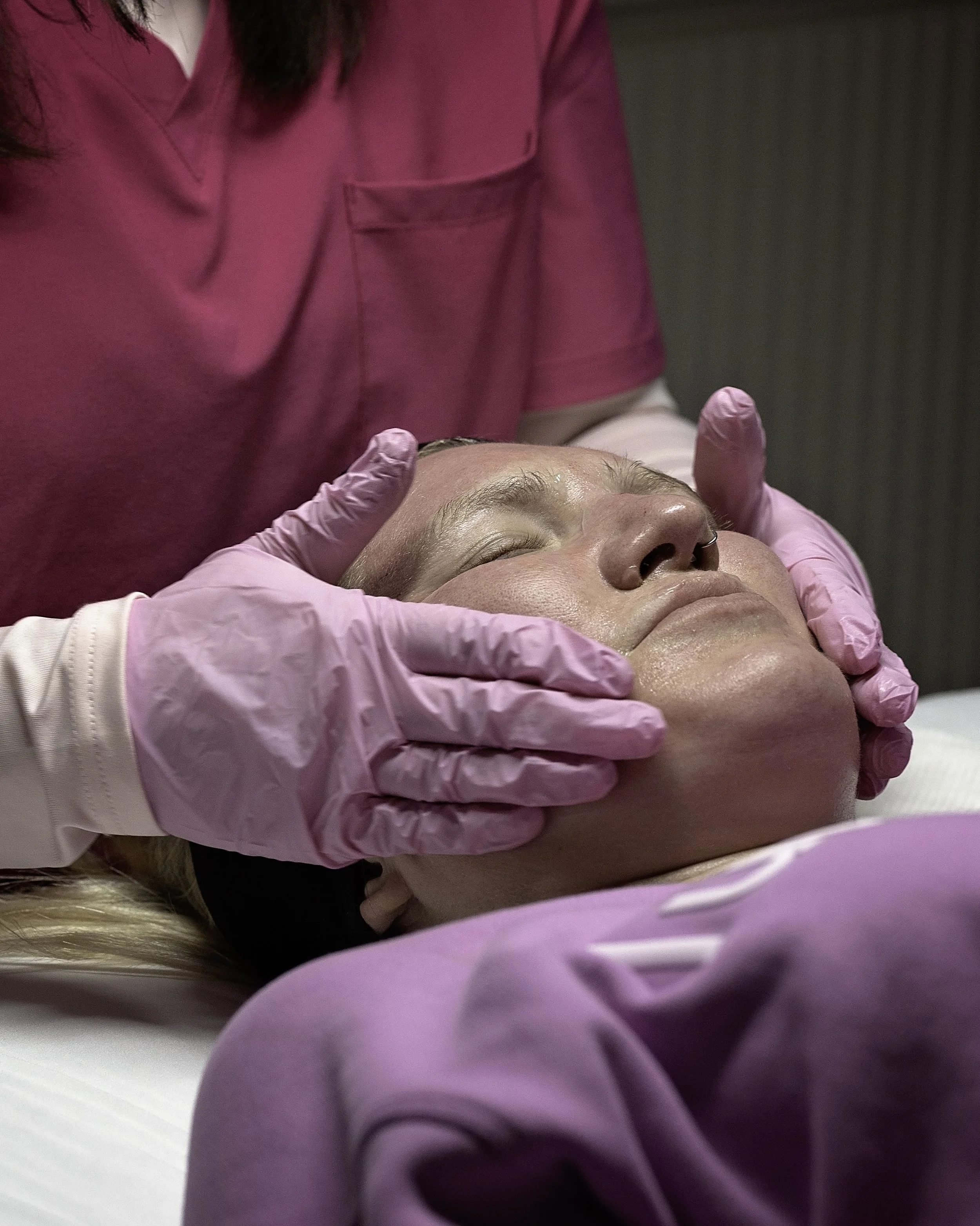 How to Prevent Hyperpigmentation During Summer