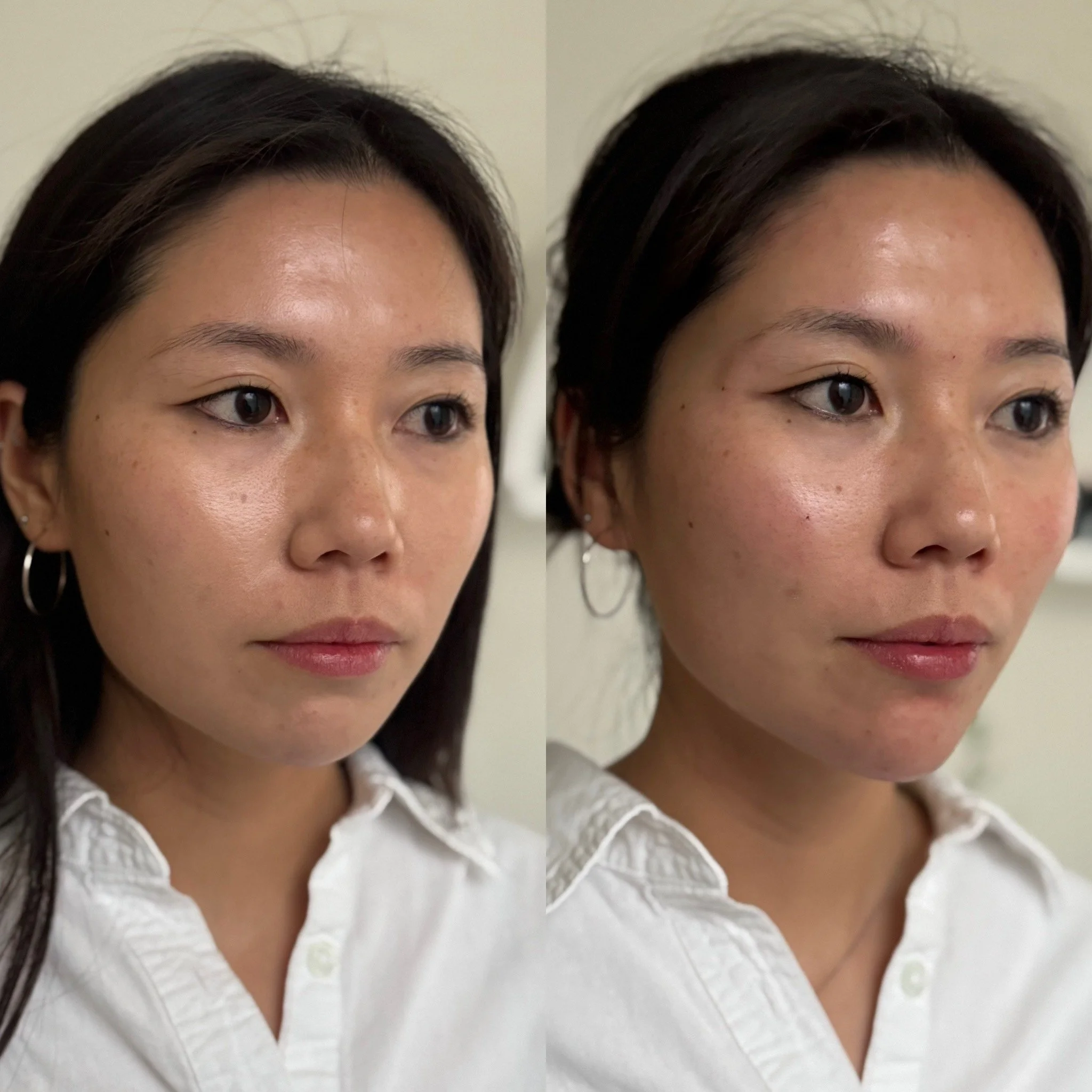 Comparison of a woman's face before and after skincare, showing improved skin texture and glow.