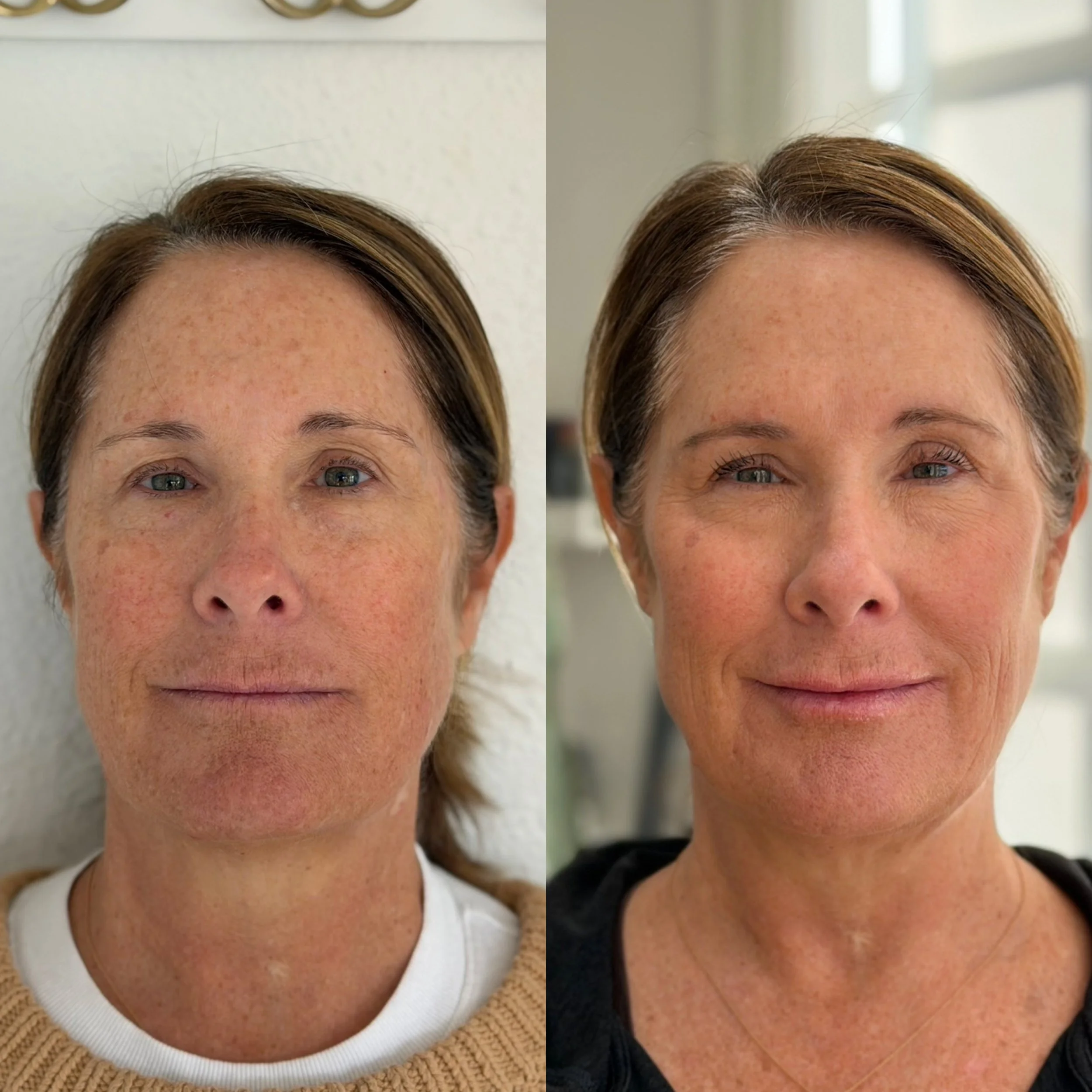 Side-by-side comparison of a woman's face before and after skincare treatment, showing reduced redness, spots, and an overall clearer complexion in the after photo.