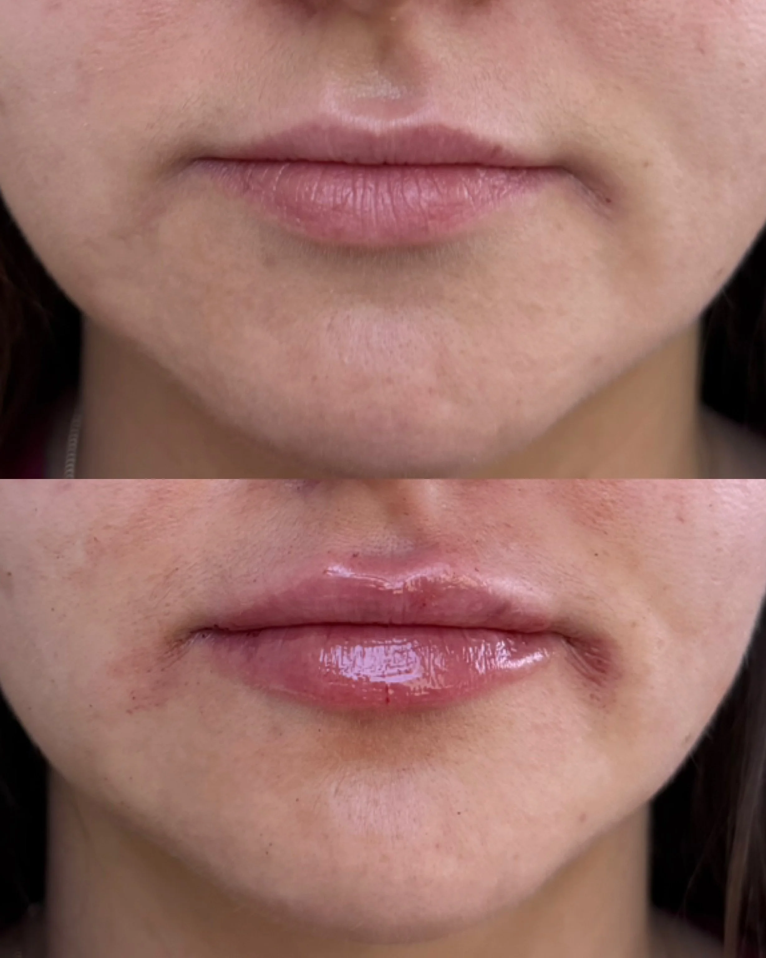 Close-up of a person's lips, shown before and after applying lip gloss.