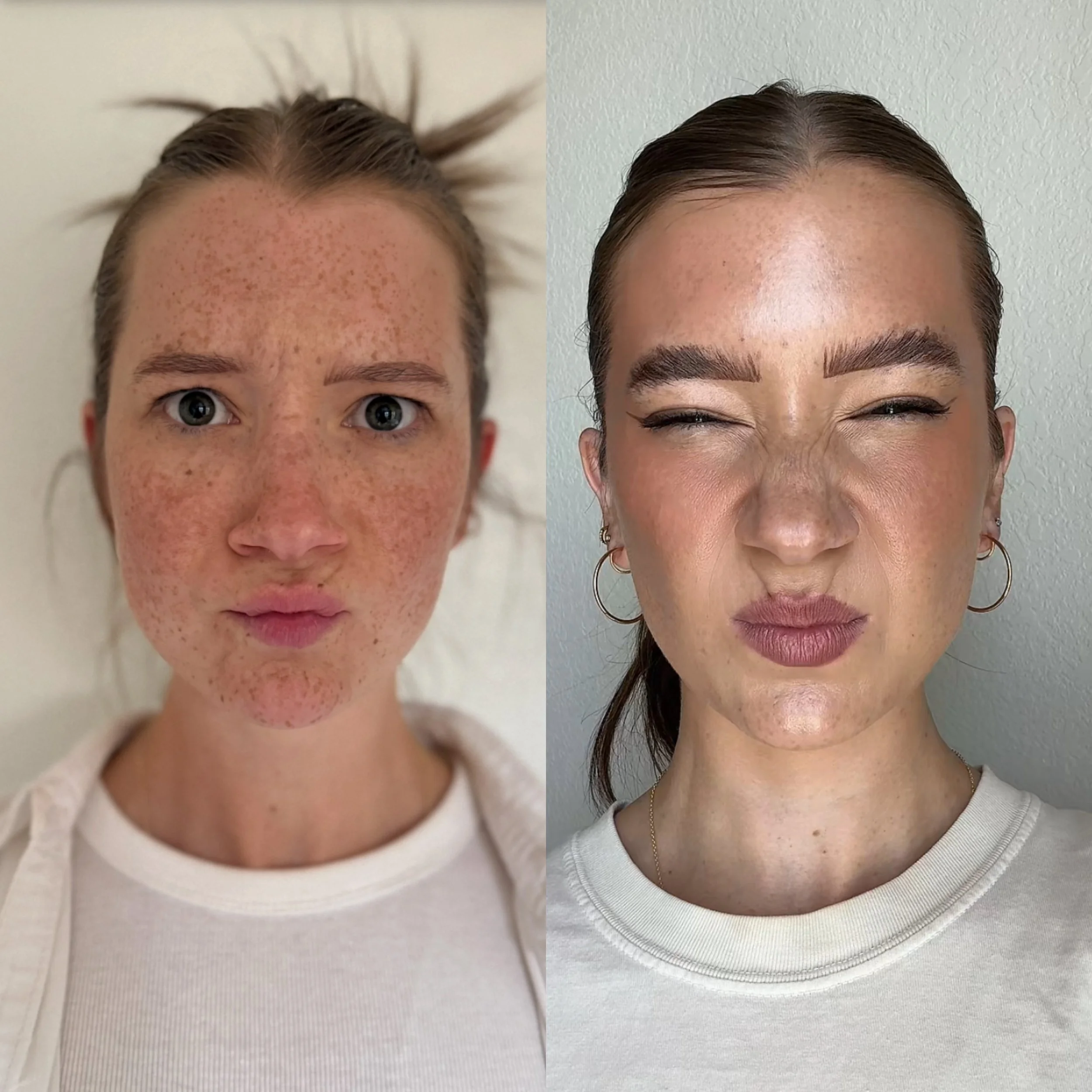 Side-by-side comparison of a woman showing before and after skin improvement, with visible reduction in freckles and blemishes.
