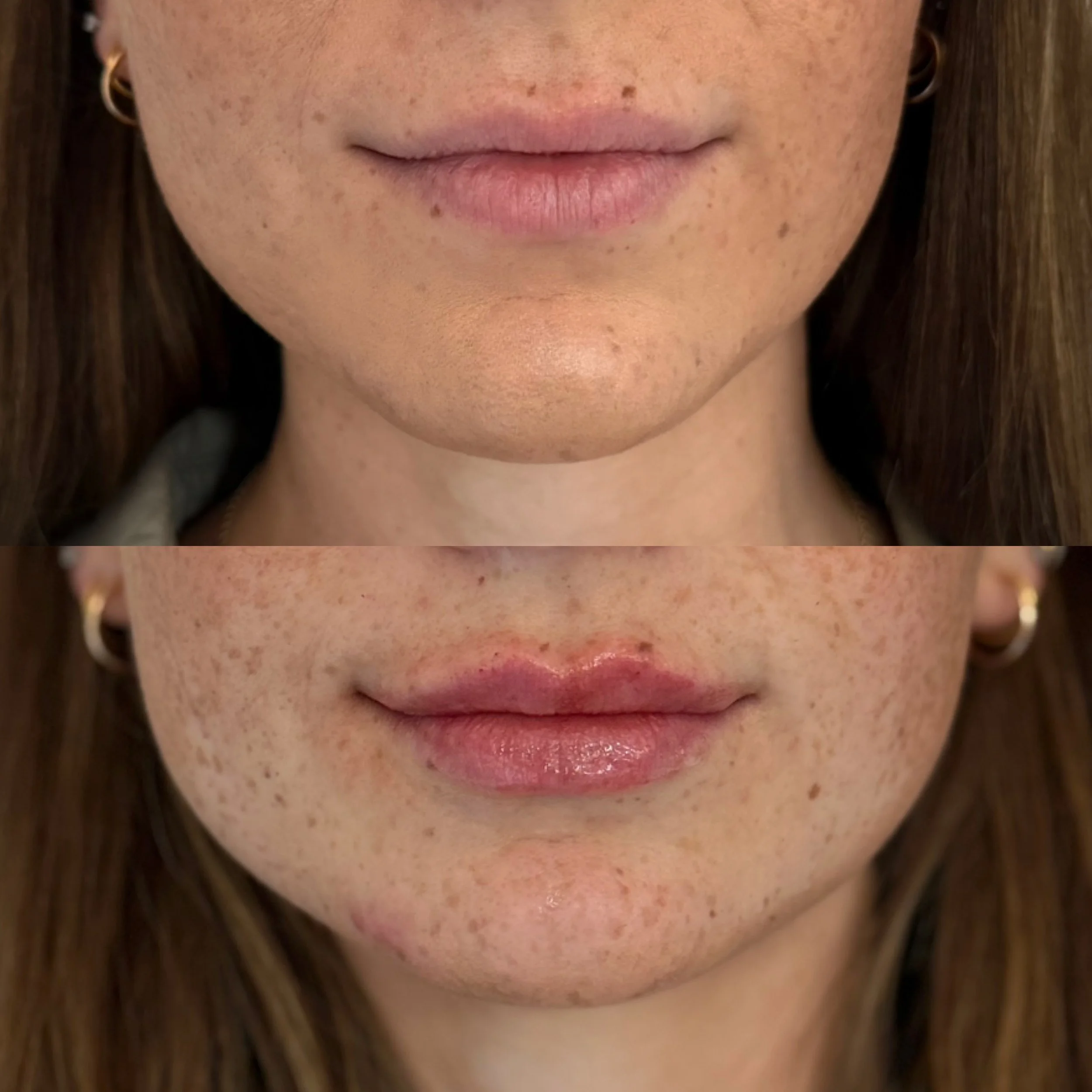 Close-up of a woman's lips and chin, with the top image showing bare lips and the bottom image showing lips with lip gloss, revealing natural lip color and freckles on her face.