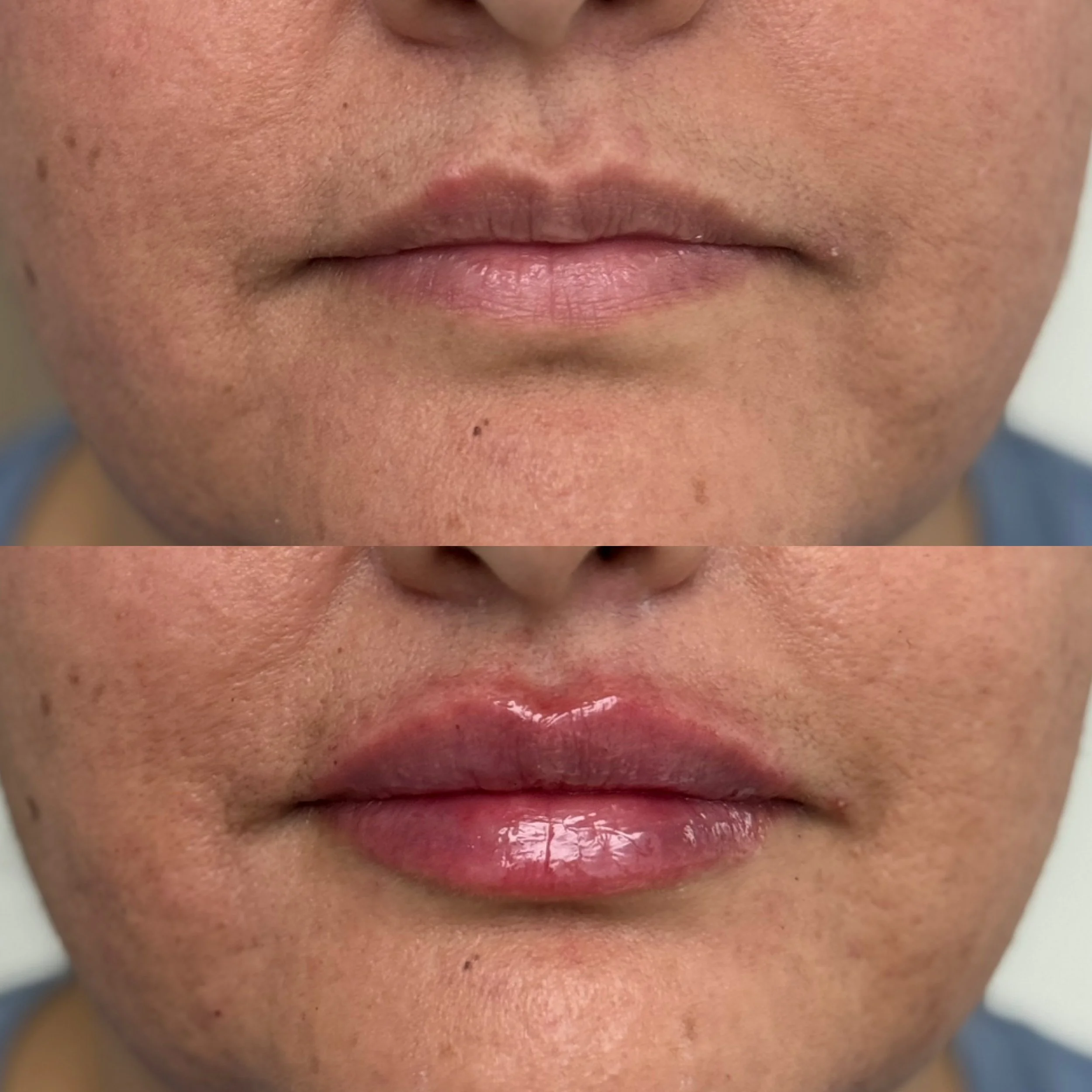 Close-up of a person's lips before and after applying lip gloss, showing a transition from natural to glossy lips.