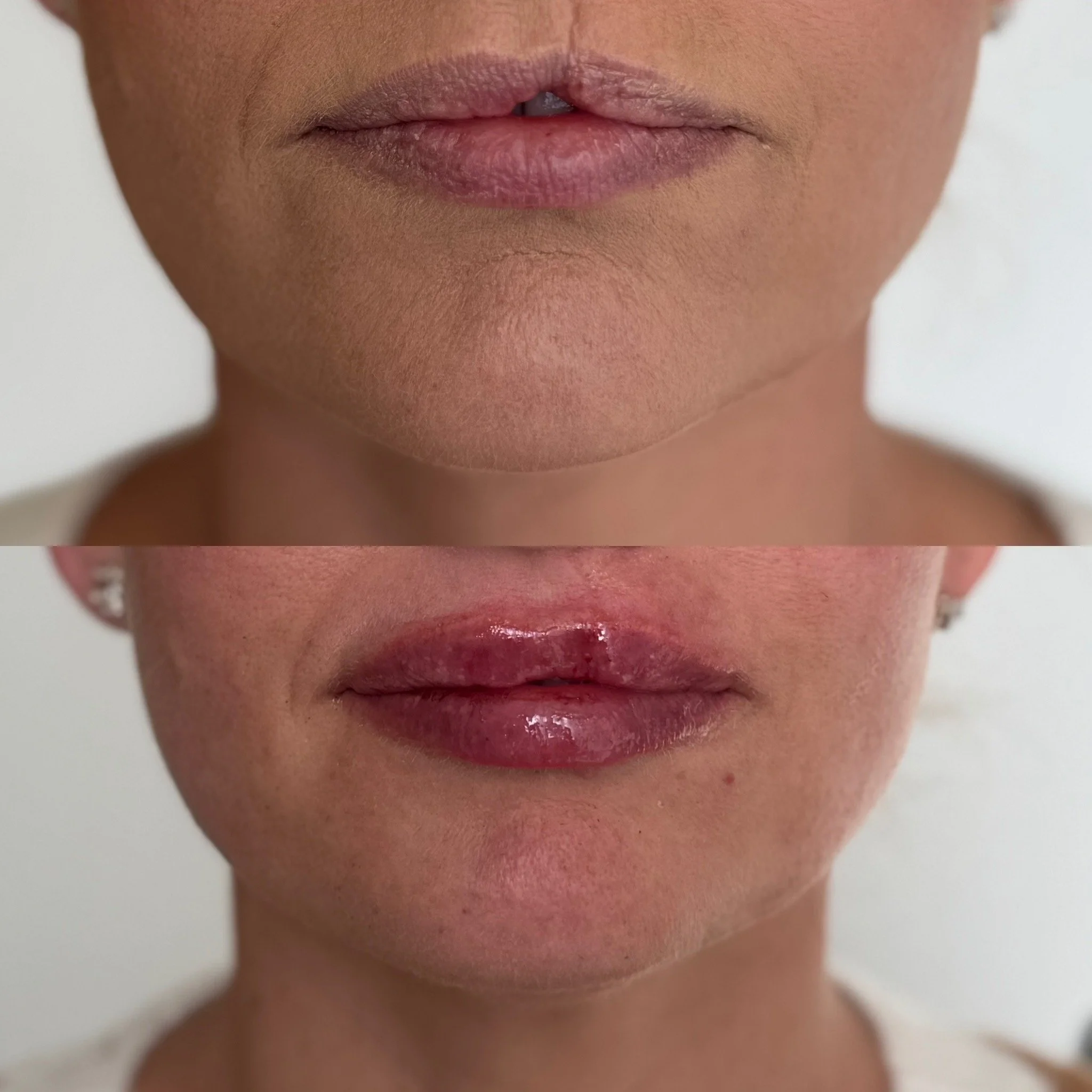 Comparison of lips before and after applying lip gloss.