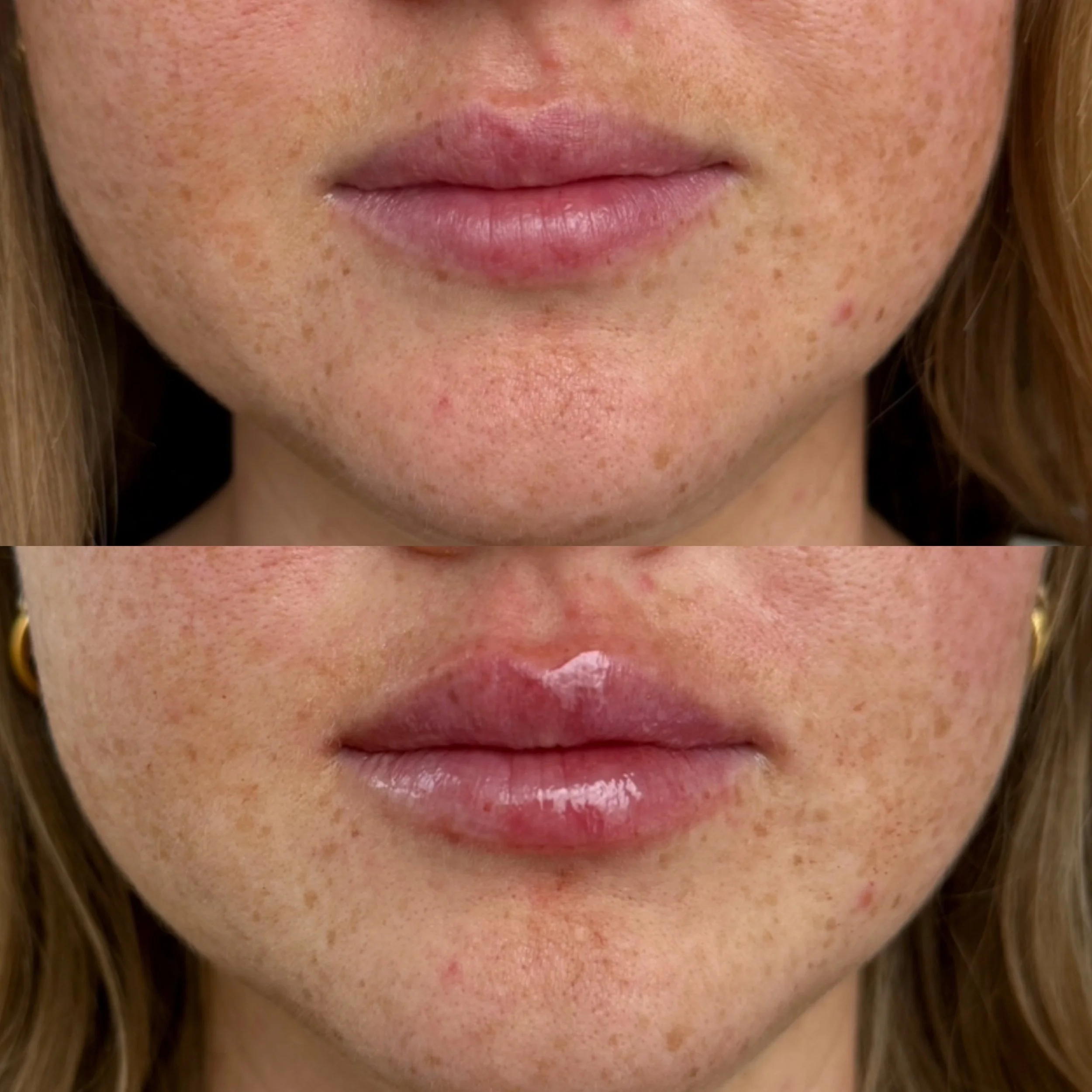Comparison of a person's facial skin before and after applying skincare, showing improved skin texture and reduced blemishes.