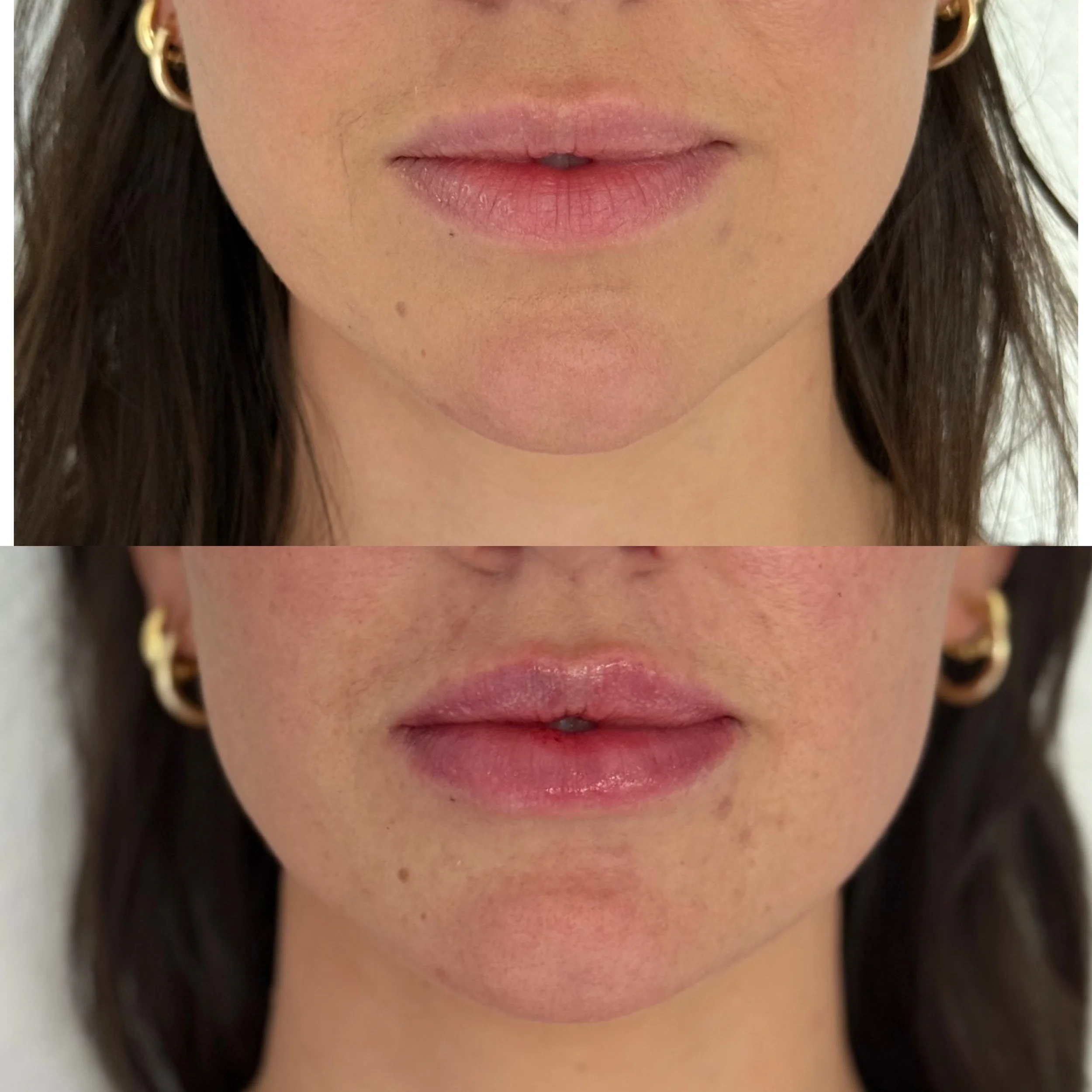 Close-up of a woman's lips and lower face before and after applying lip gloss, with gold hoop earrings visible in both images.