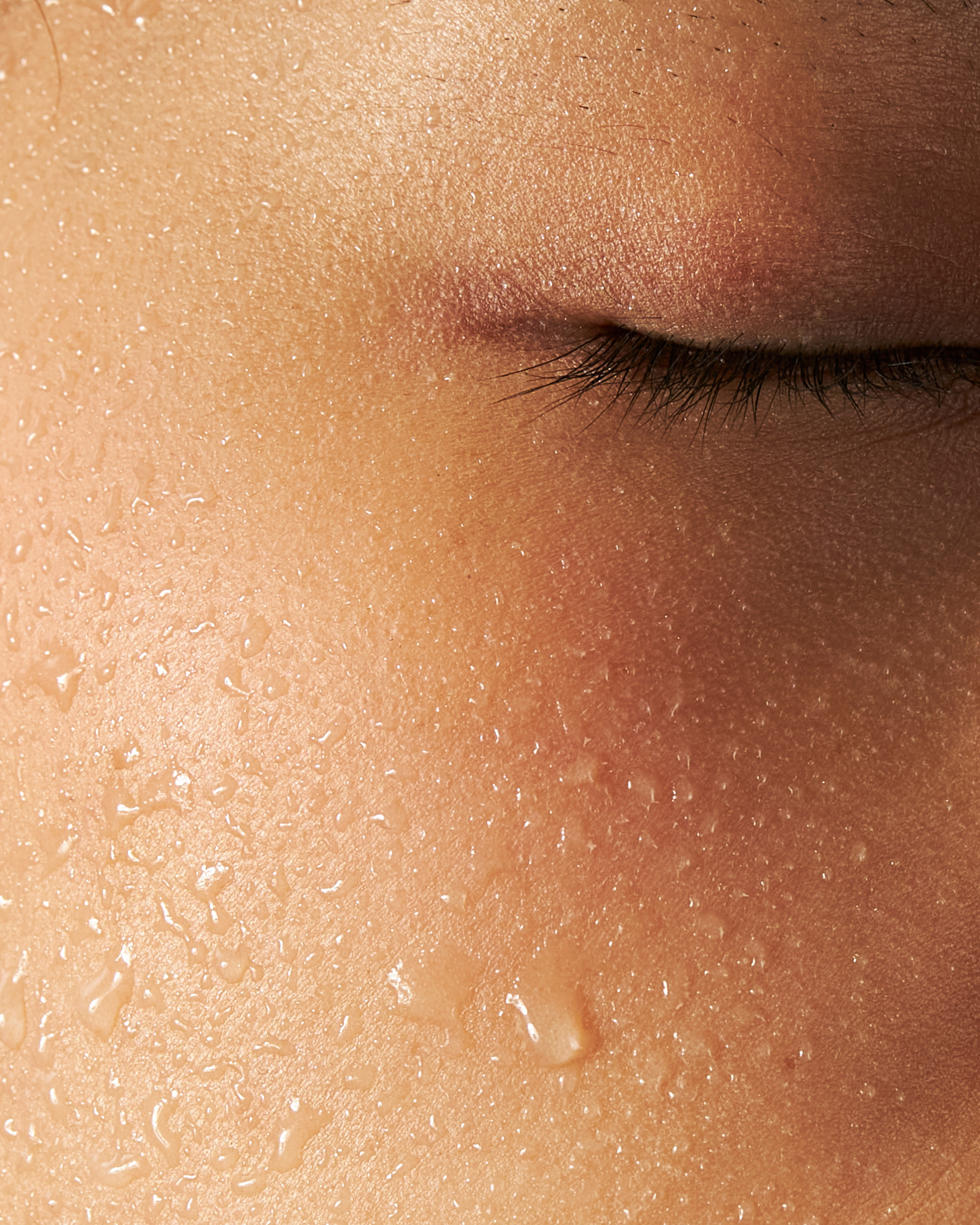 Skin Resurfacing