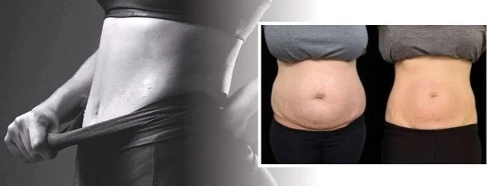 Before and after photo of a person's waist showing weight loss or toning.