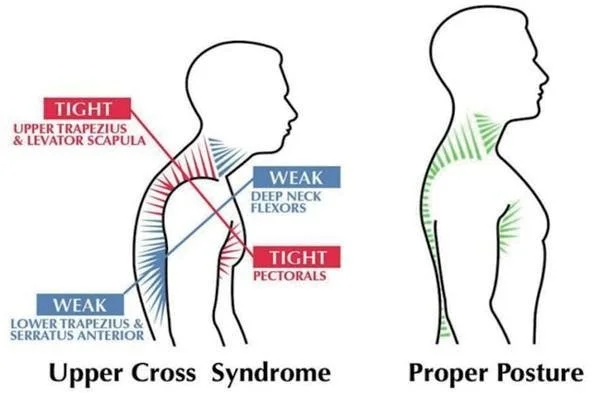 Office Worker Neck Pain and Headaches: How Osteopathy Can Help