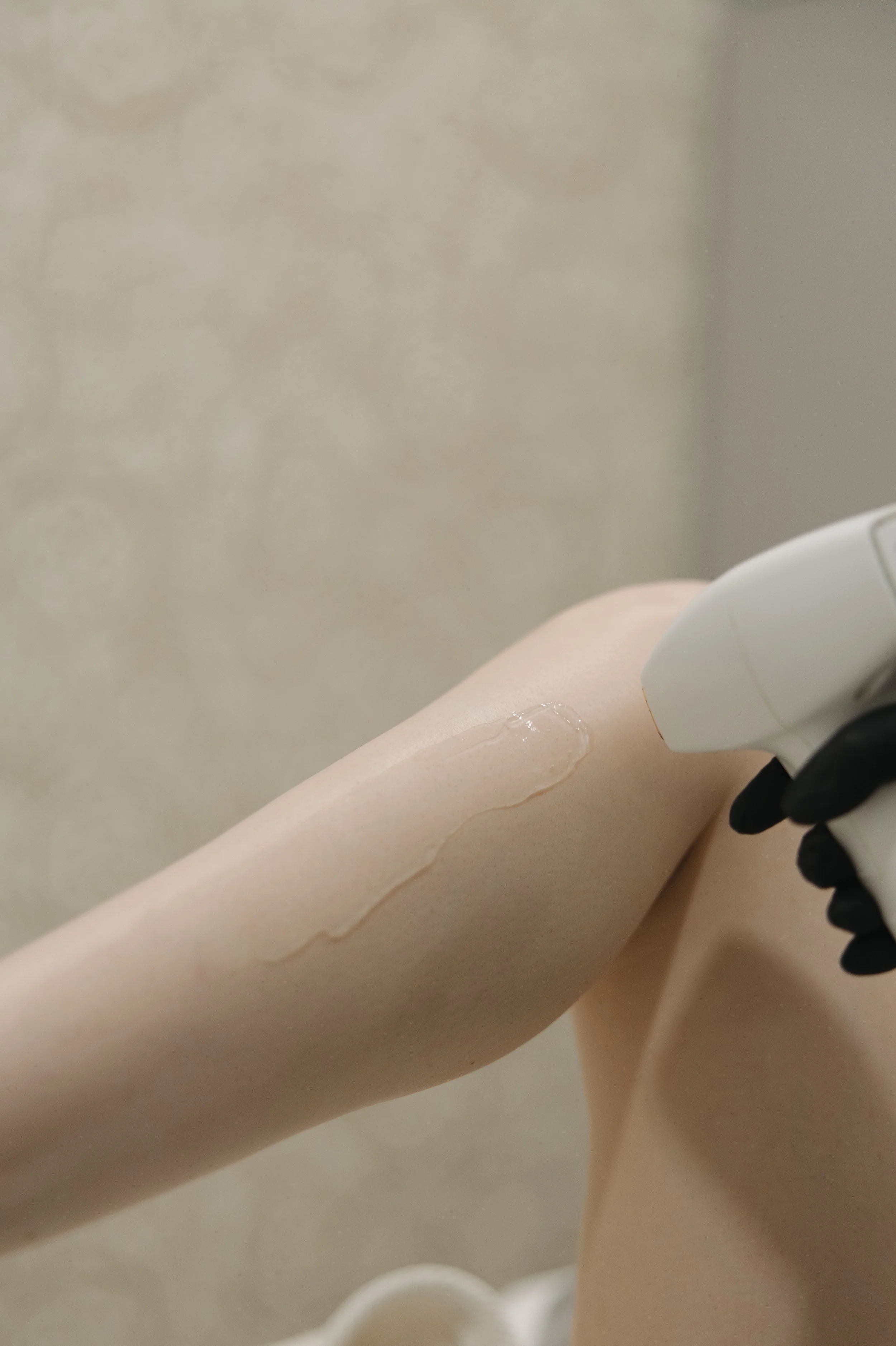 Medspa in West Fargo, ND, 58078 | Laser Hair Removal Near Me