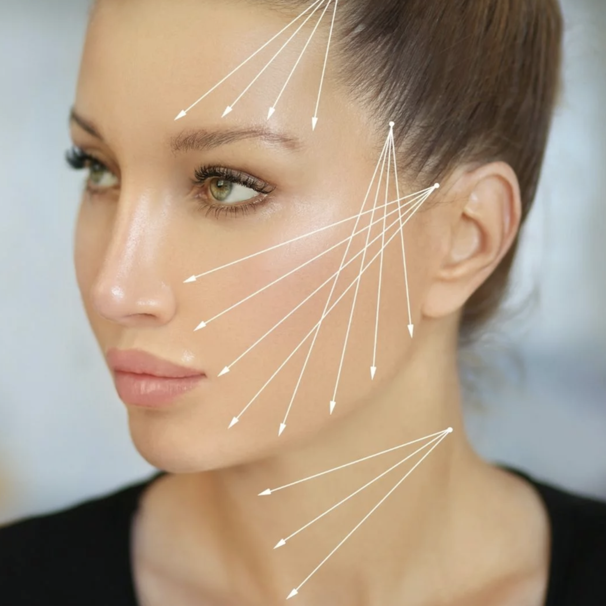 Absorbable PDO Threads