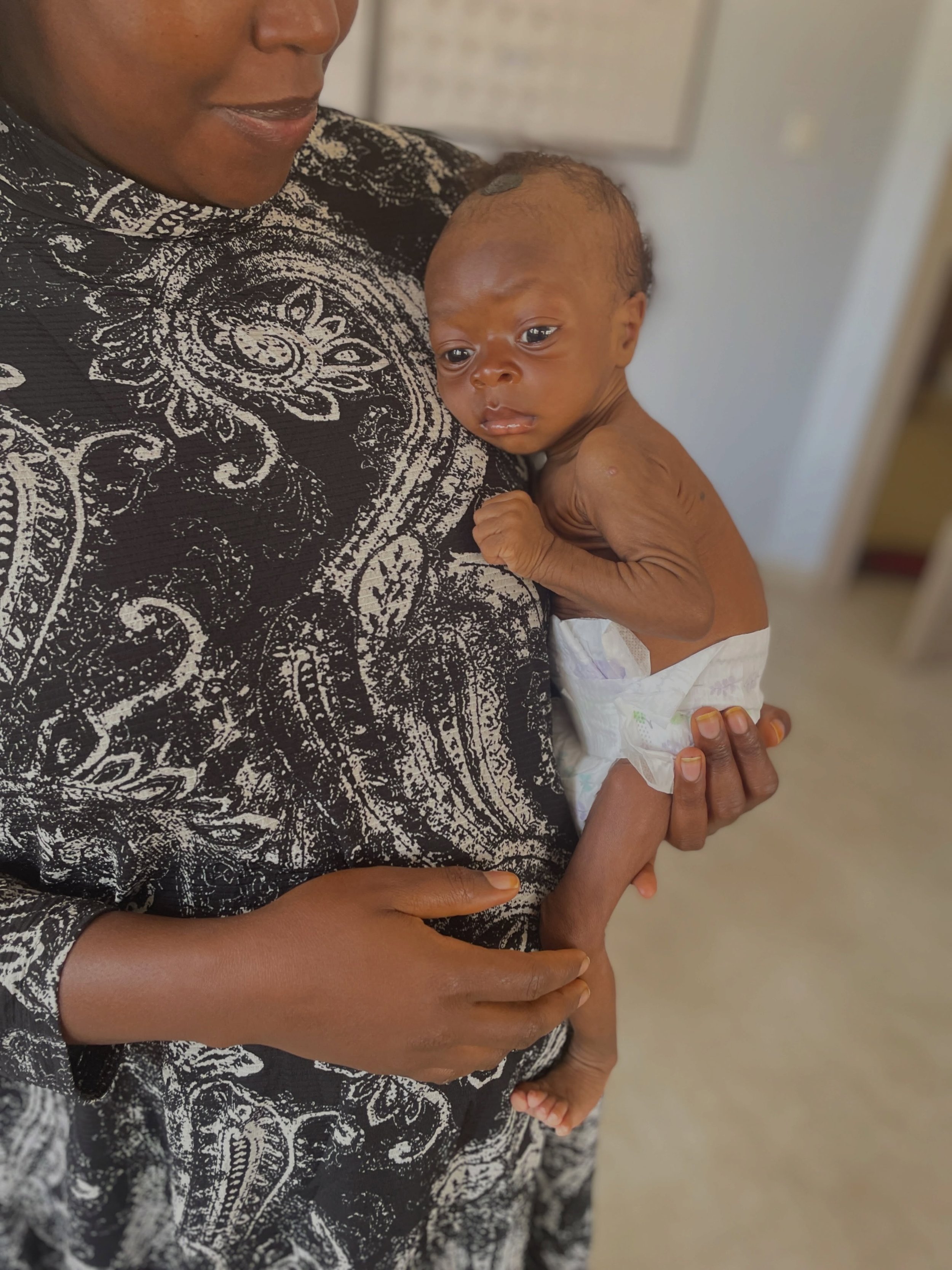 Swipe to see this boys glow up! Featuring his amazing mom and all her hard work. Lactation support saves lives &hearts;️

3.2kg (7.0lbs) 4 months old ➡️ 7.2kg (15.8lbs) 7 months old