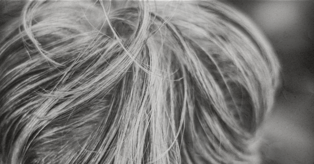 One of the Rare Reversible Causes of Hair Graying