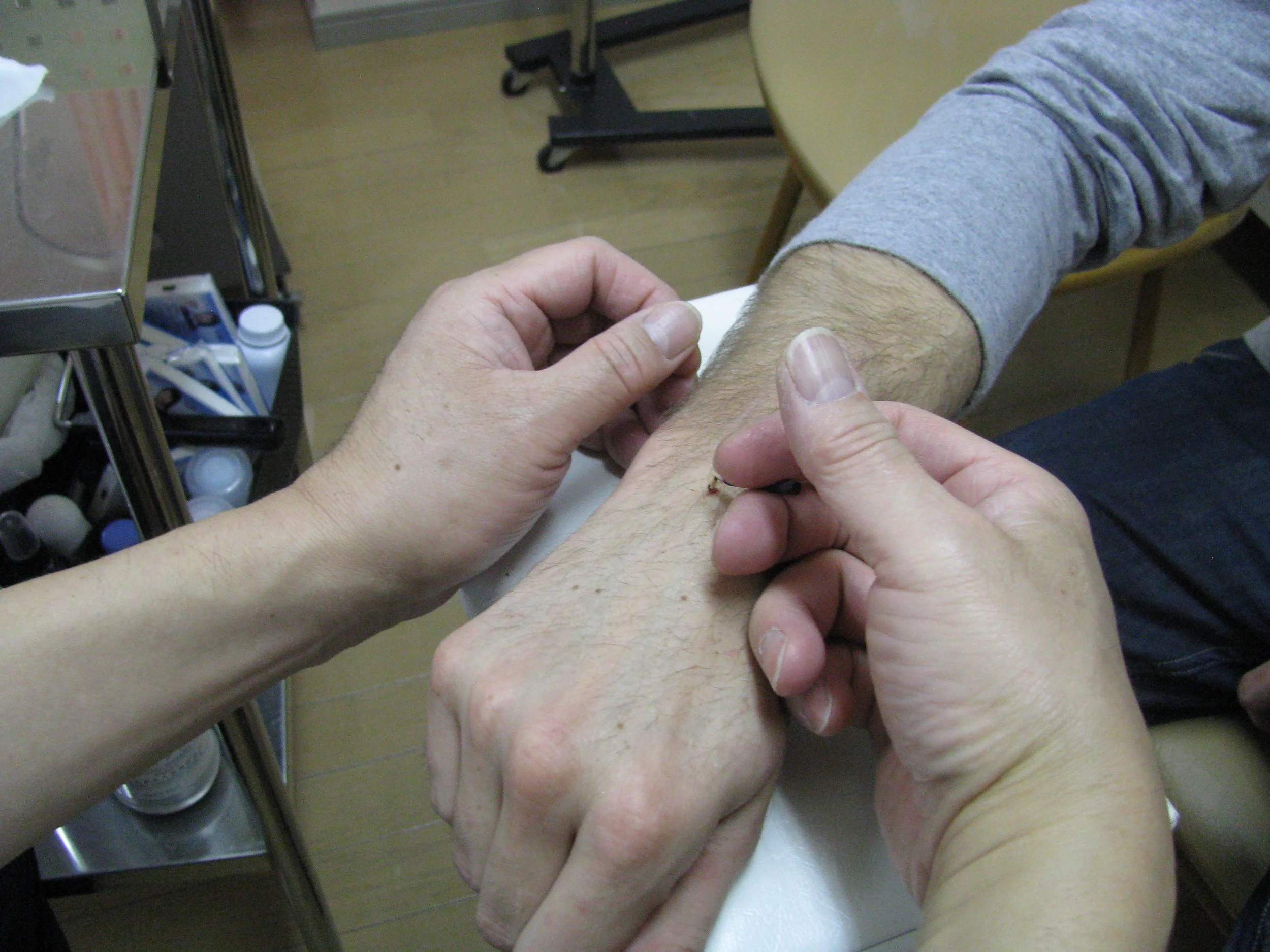 30–40 Minute Moxibustion & K-Taping Therapy