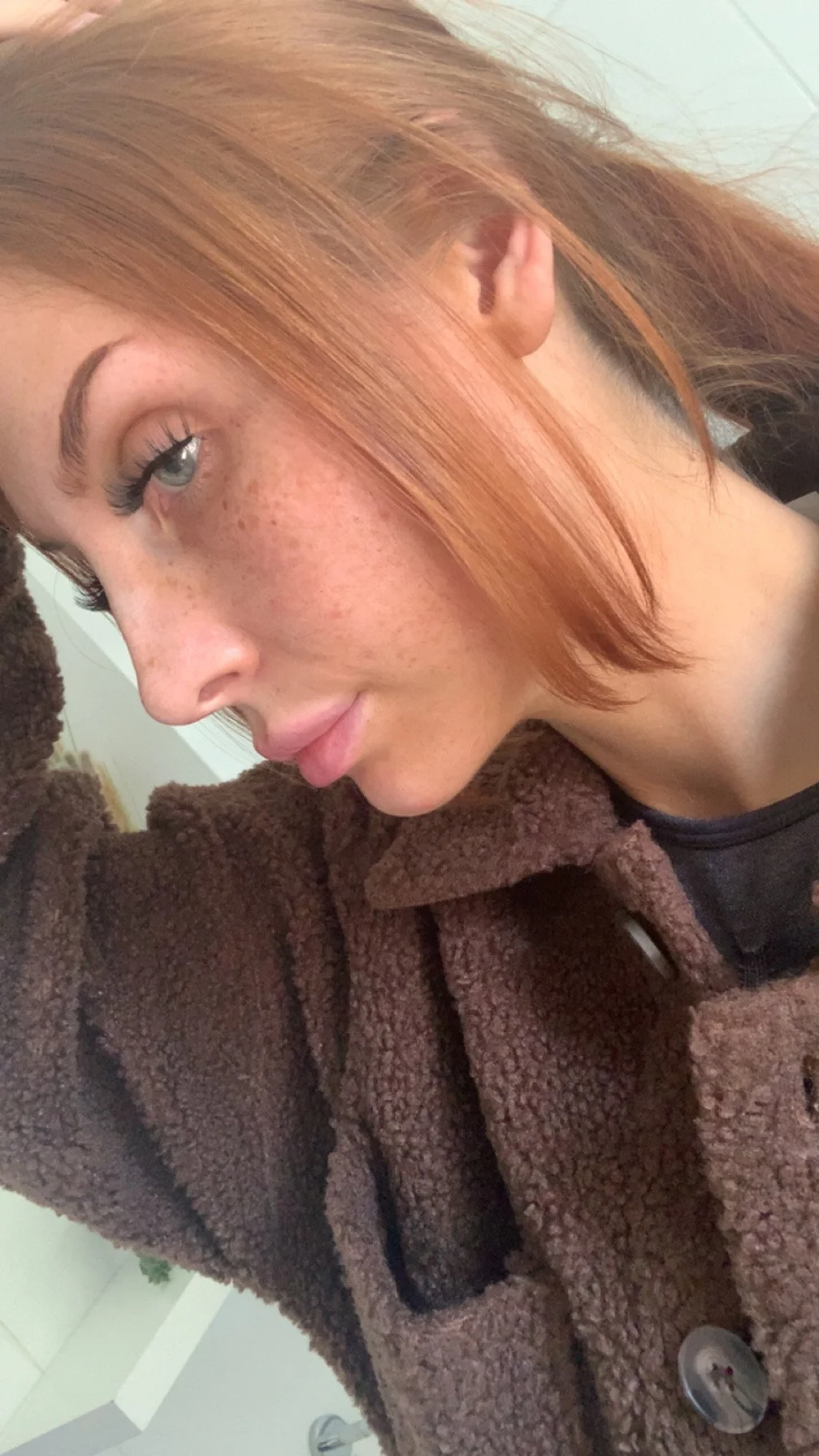 nose job injectable maidstone kent.jpg