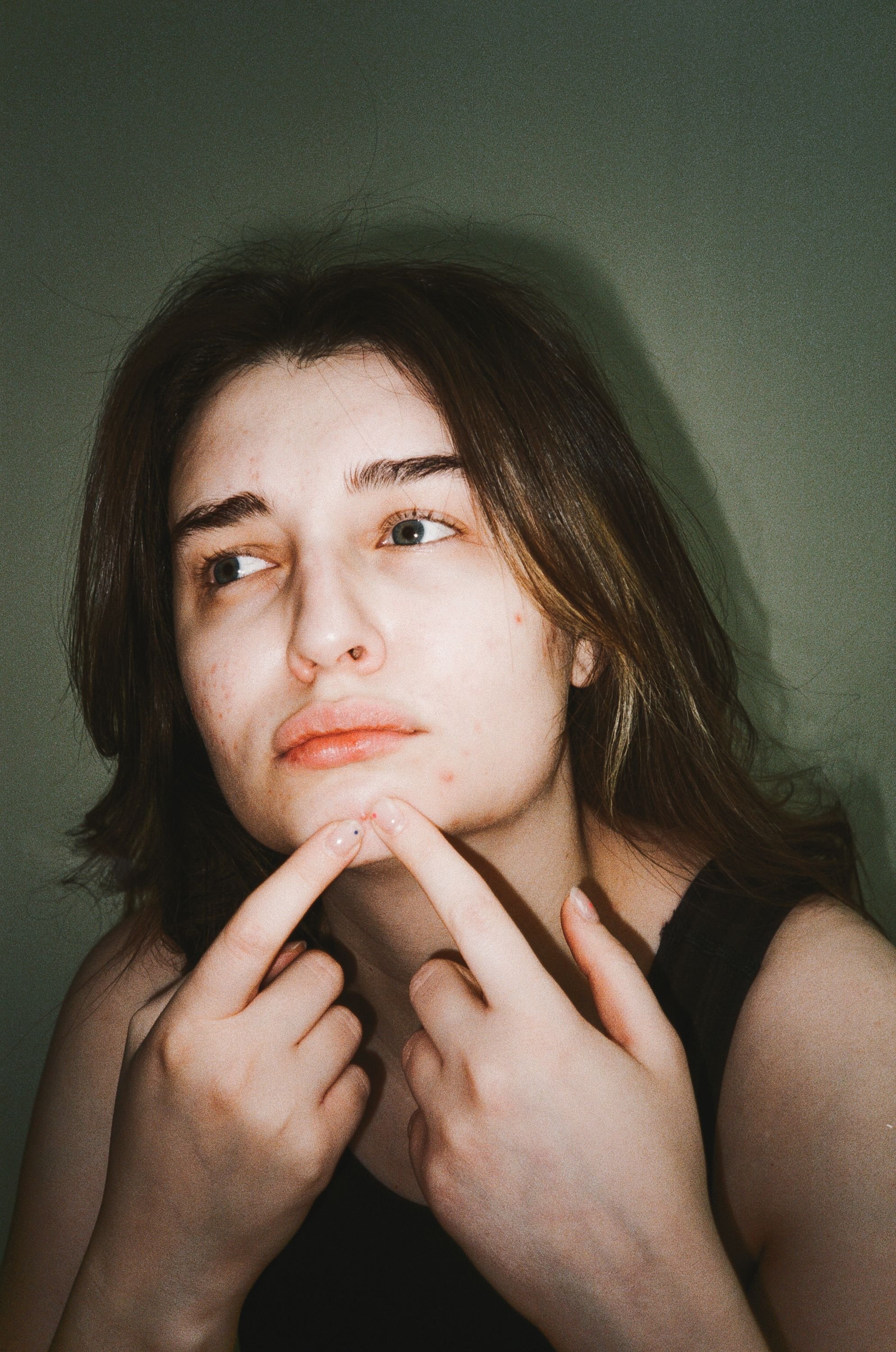 7 Hidden Acne Triggers Hiding in Your Wellness Routine