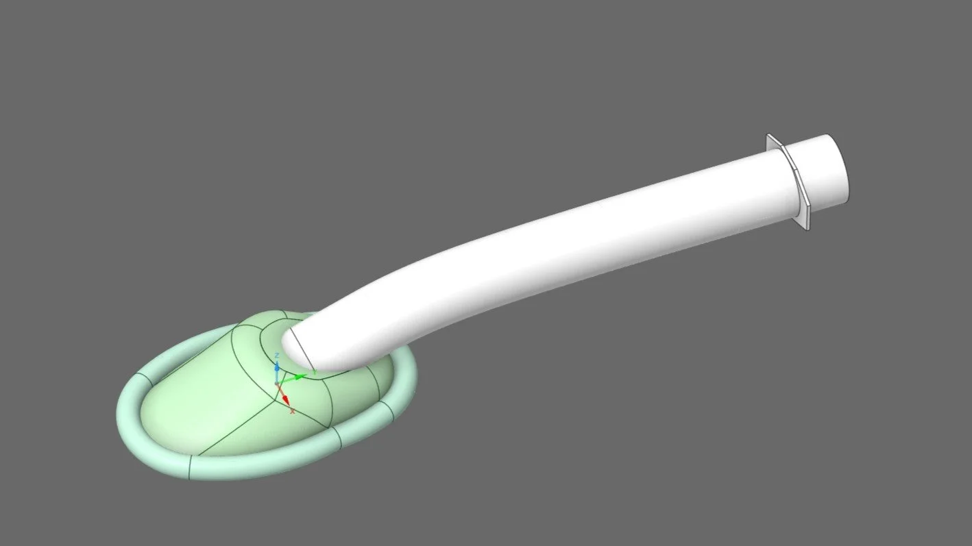 Supra-Glottic Airway device.jpg