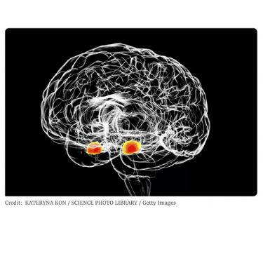 A brain scan showing the amgdalae