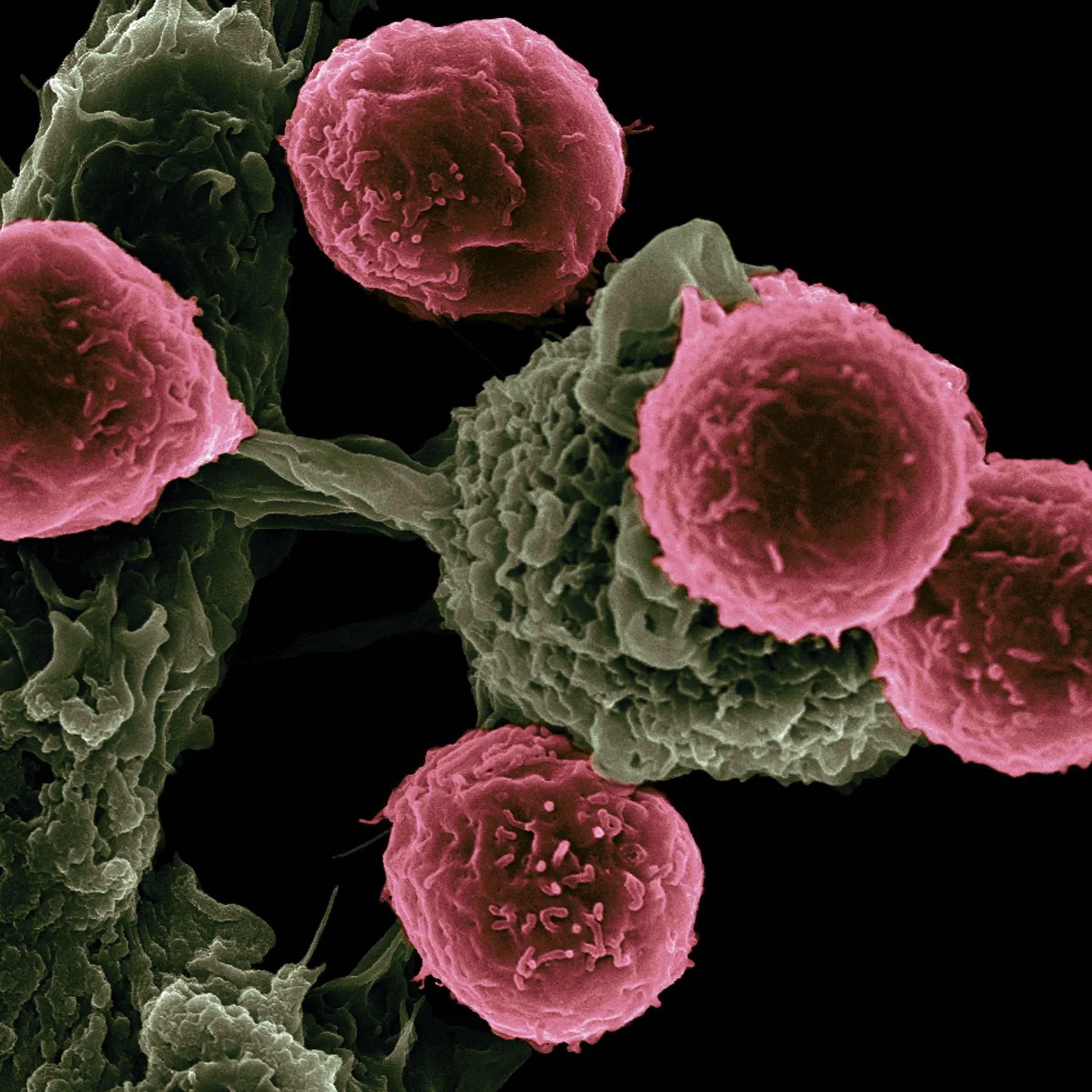 Human Papilloma Virus (HPV)
