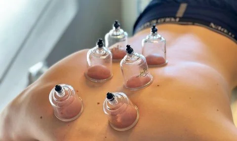 Schröpfen / Schröpfmassage