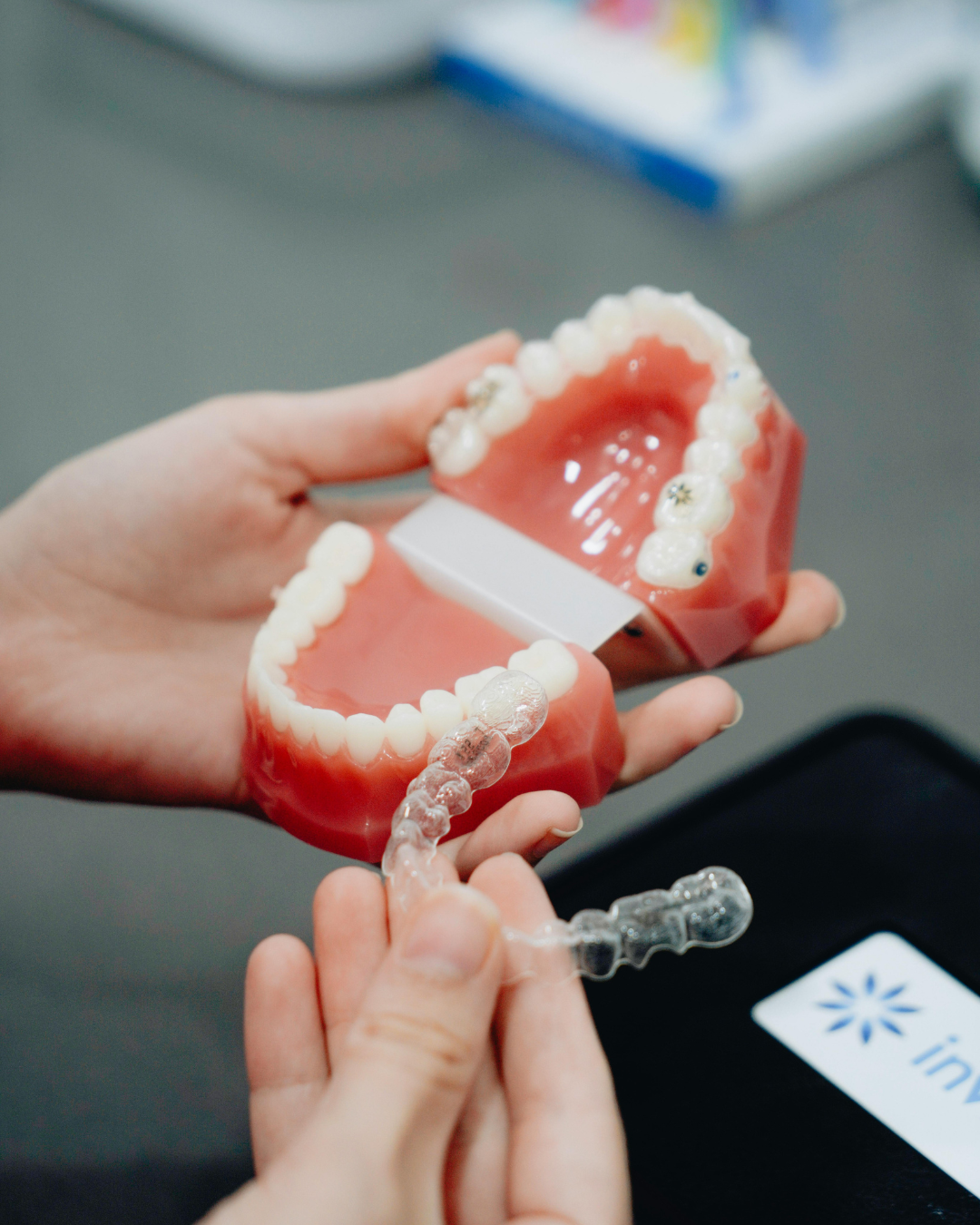 Quanto tempo dura um tratamento com Invisalign?