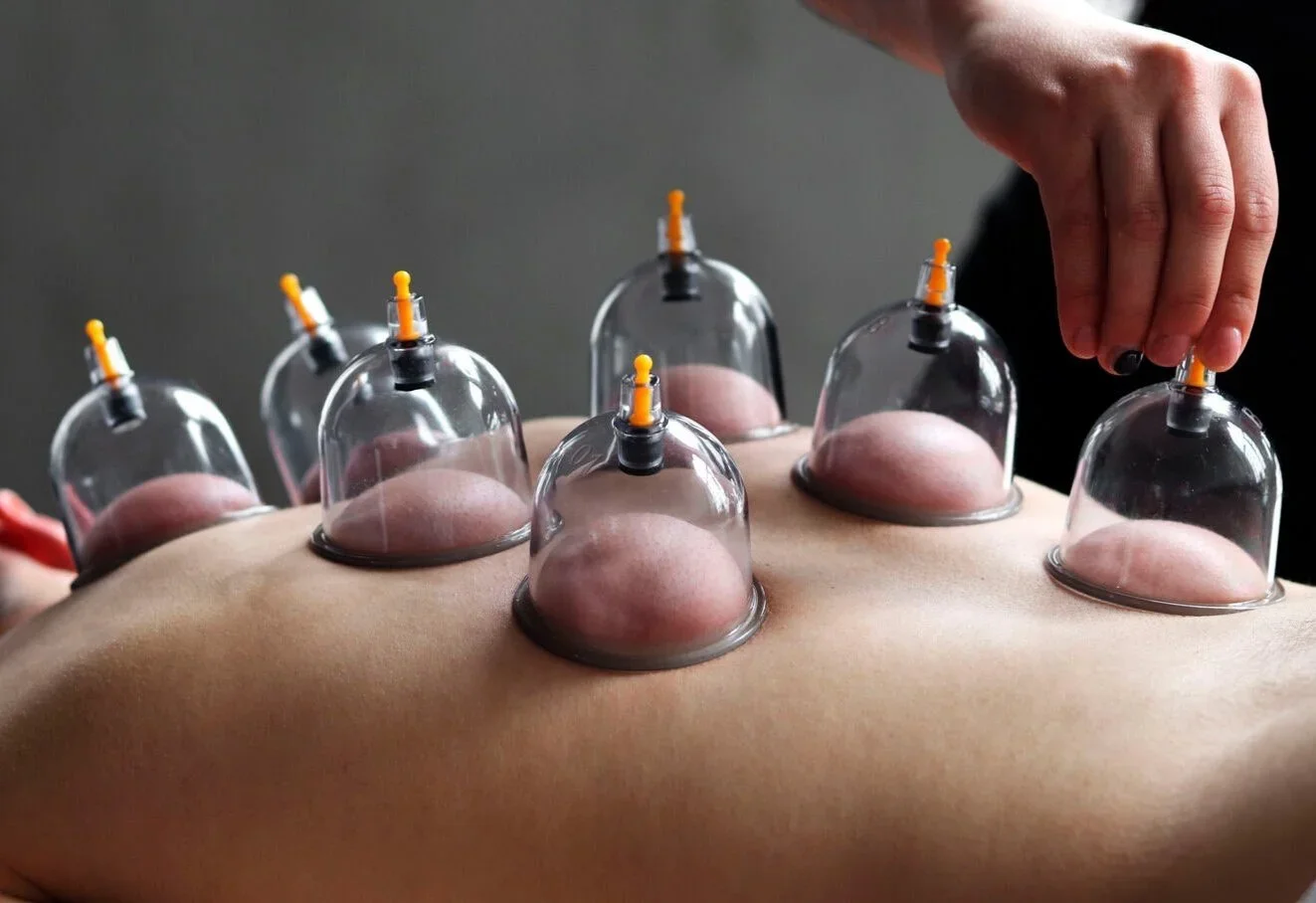 CUPPING+THERAPY+CYRIL+LAGEL+-+003.webp
