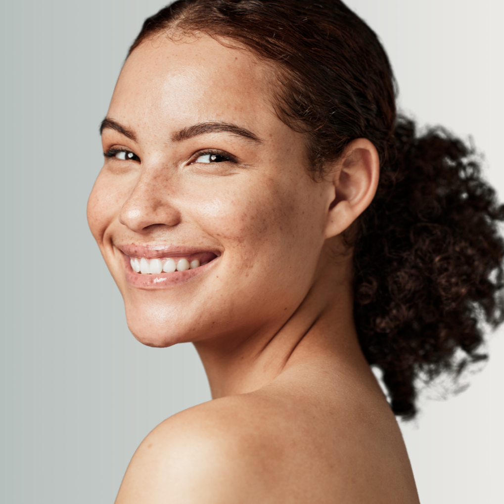 Chemical Peel
