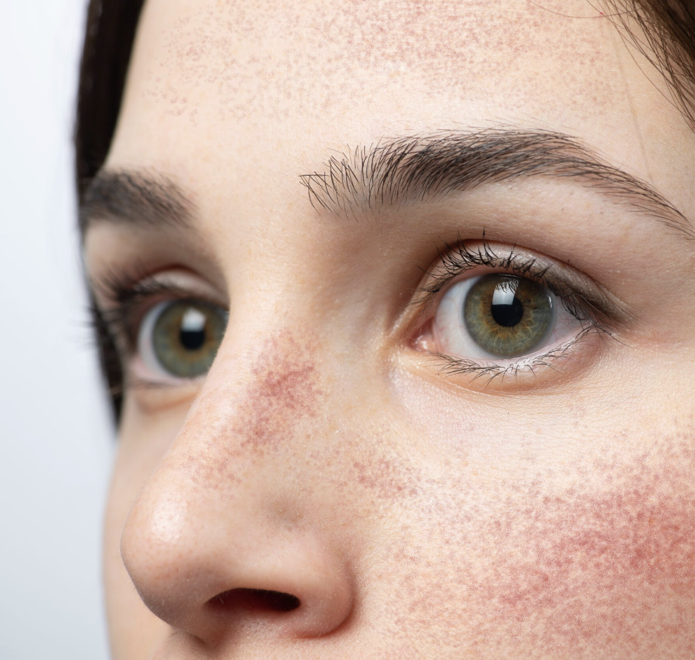 Summer Skin Survival Guide: 7 Colour Correctors That Hold Up to Redness