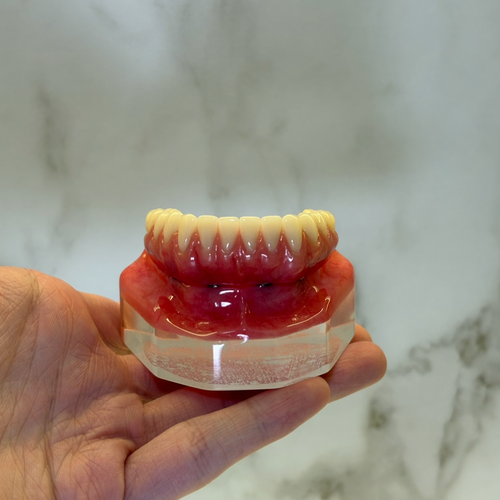 Prótese fixa sobre implantes - sorriso completo