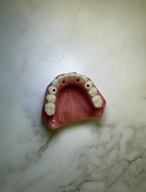 Prótese protocolo