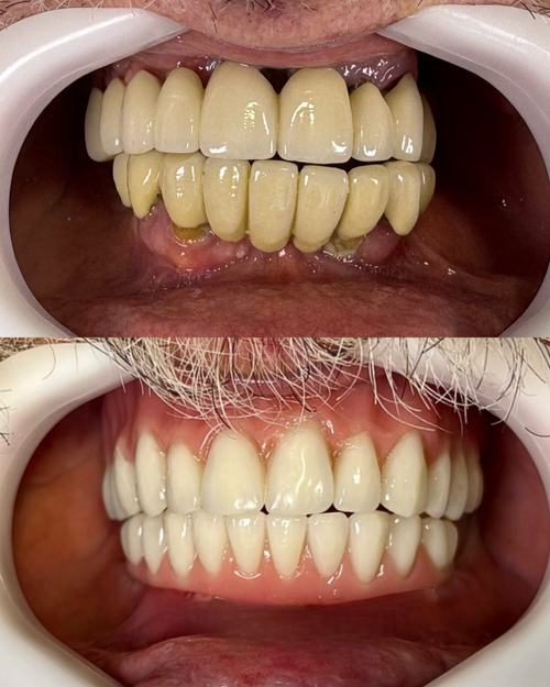 Antes e depois do tratamento