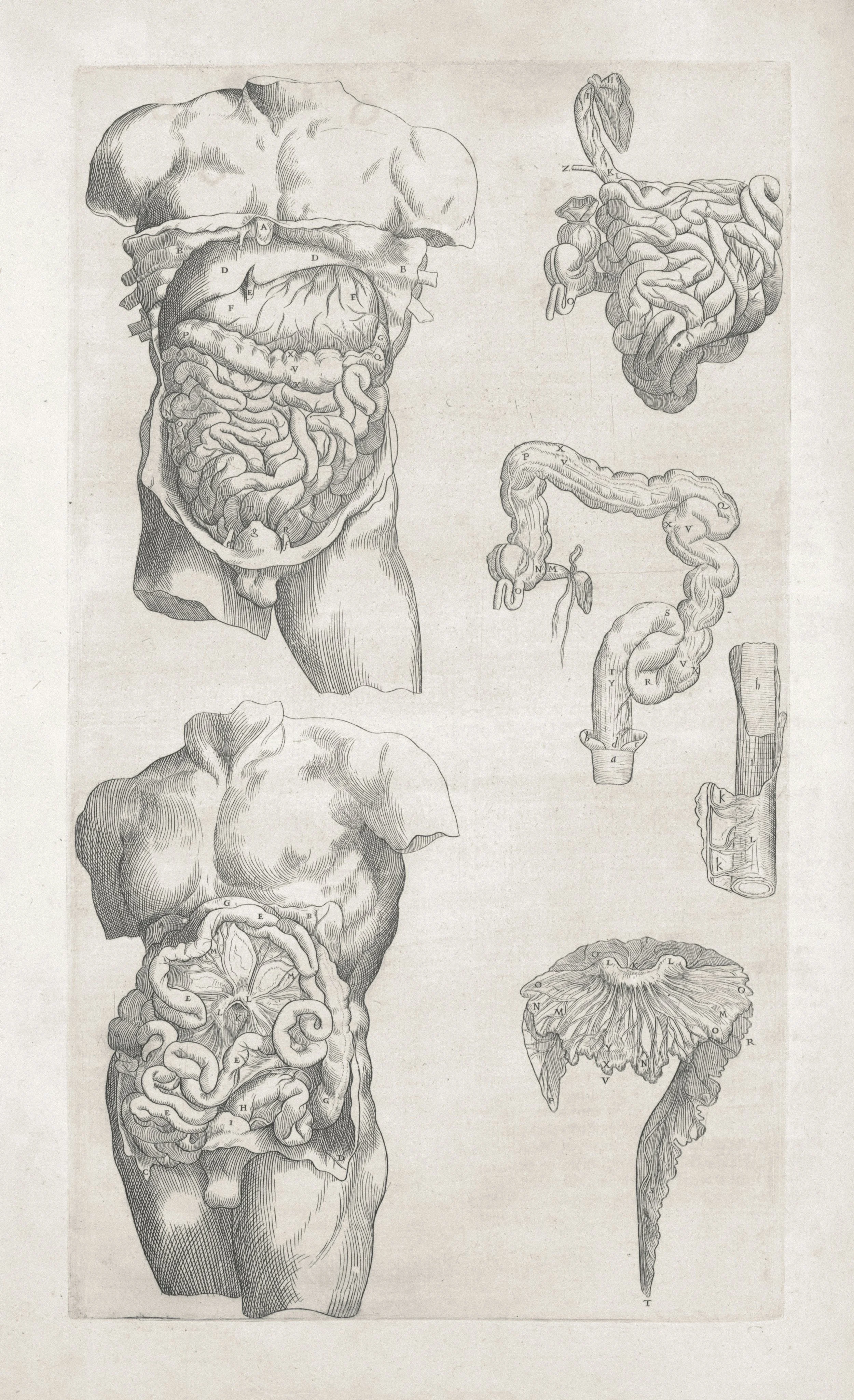 Hydrogen sulfide small intestinal bacterial overgrowth case registry
