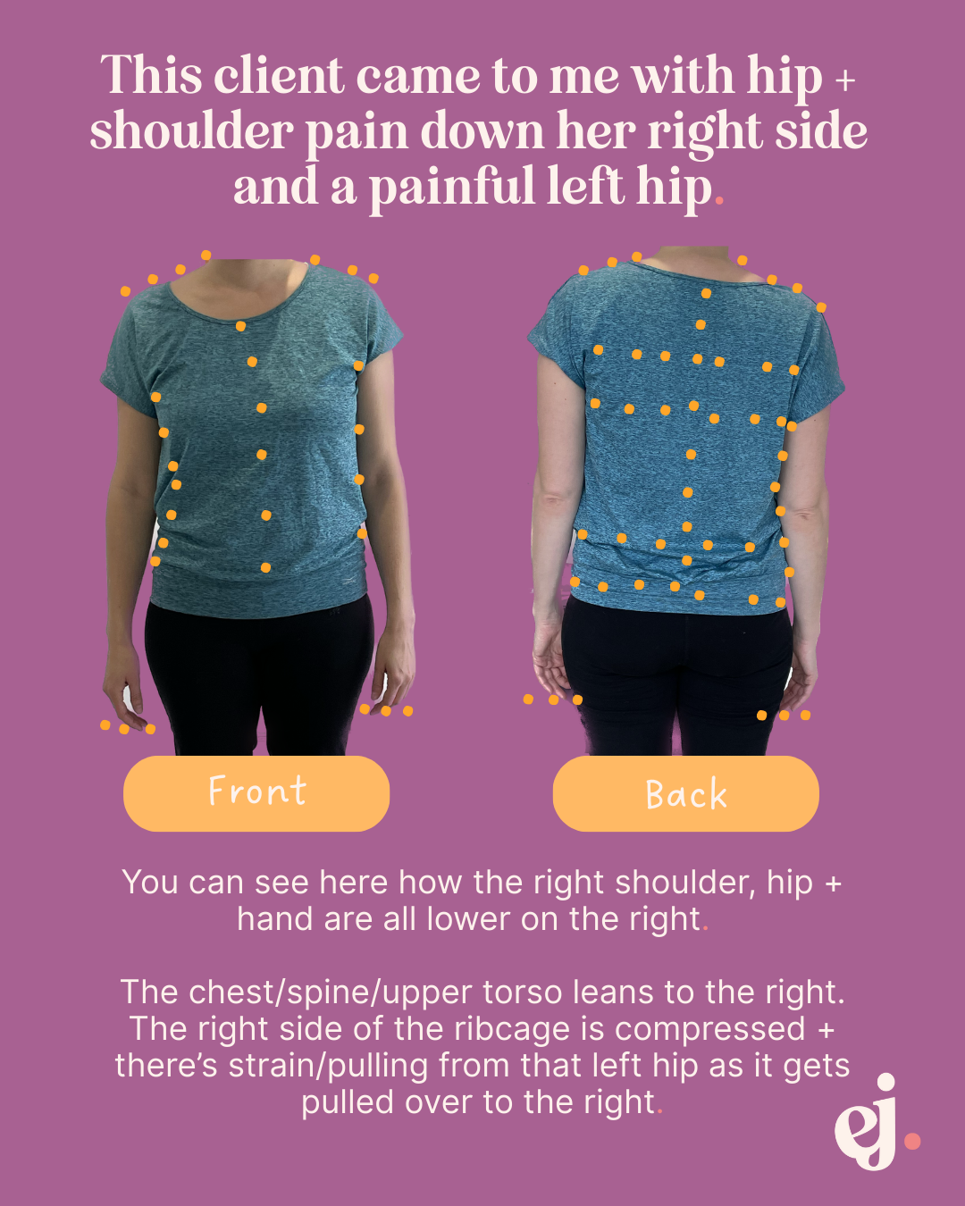 A visual guide showing a woman with hip, shoulder pain, and a painful left hip. The front and back views of her body are marked with orange dots indicating areas of concern. The text explains how her right shoulder, hip, and hand are lower on the rig