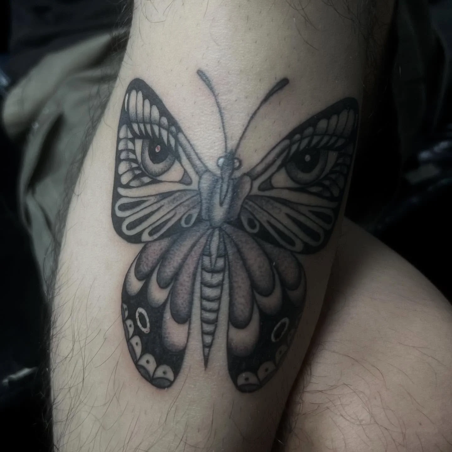 Healed, thank you!
