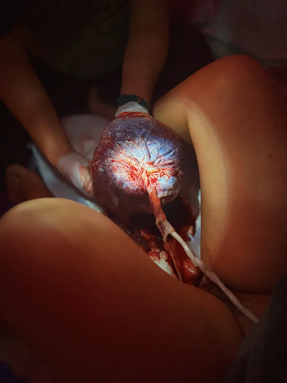 Close-up of a newborn baby's placenta, a mother and baby fresh after birth, being held gently by two hands of a midwife and doula during delivery in a dark environment.