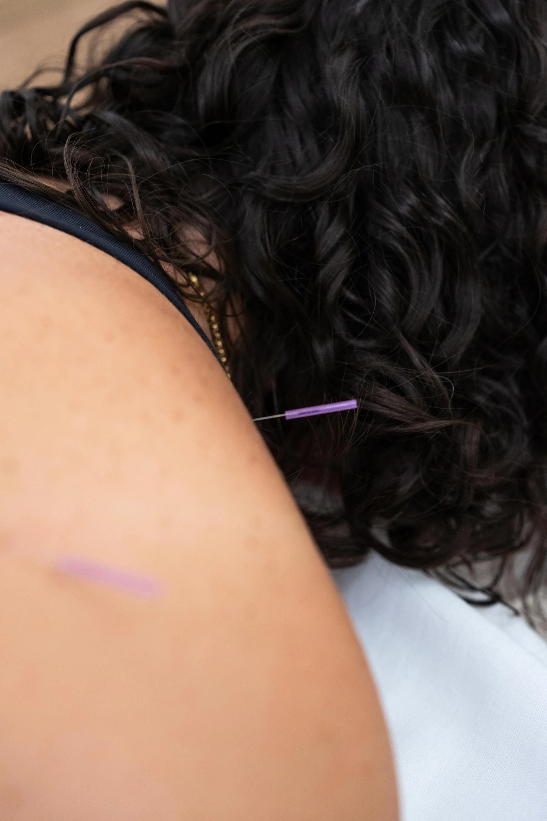 Pessoa recebendo uma injeção na parte superior do braço