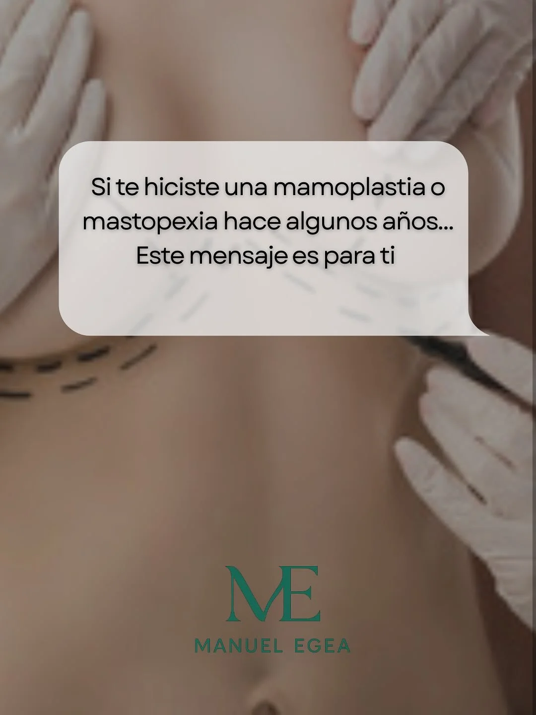 Con el paso del tiempo, el cuerpo cambia.
Y cuando existen implantes mamarios o se ha realizado una mastopexia, esos cambios tambi&eacute;n pueden reflejarse en el pecho. Esto es algo natural y esperado.

Las revisiones peri&oacute;dicas no est&aacut