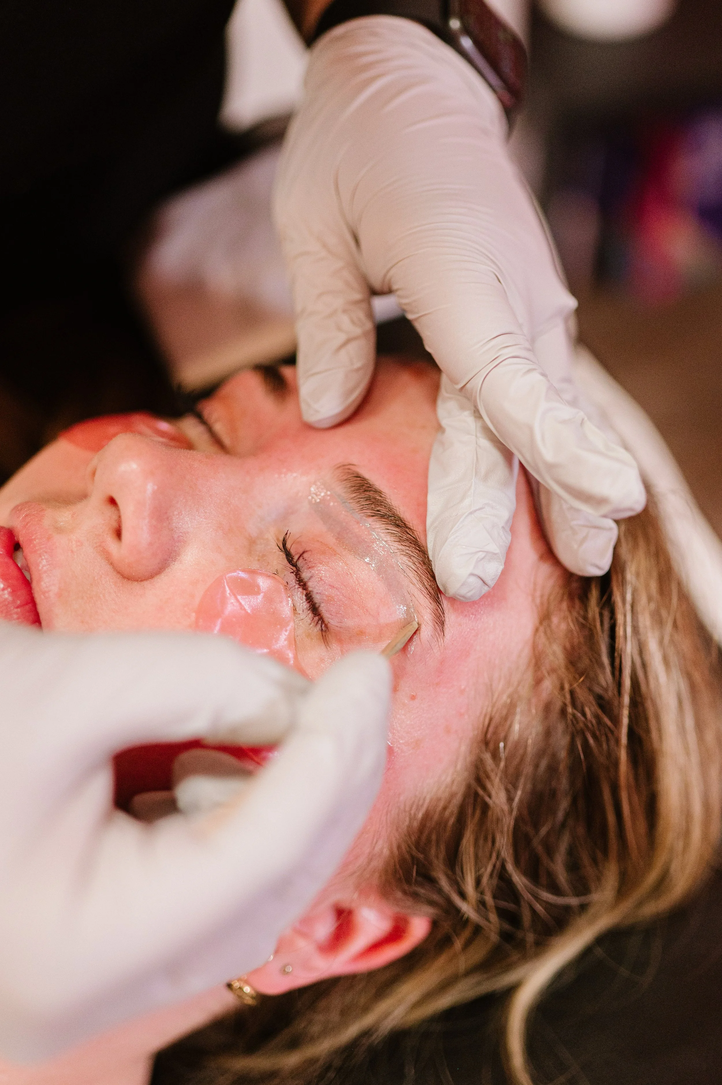 A person receiving an eyelid tattoo procedure, with a medical professional using gloves and a small needle or tool on the person's closed eyelid.