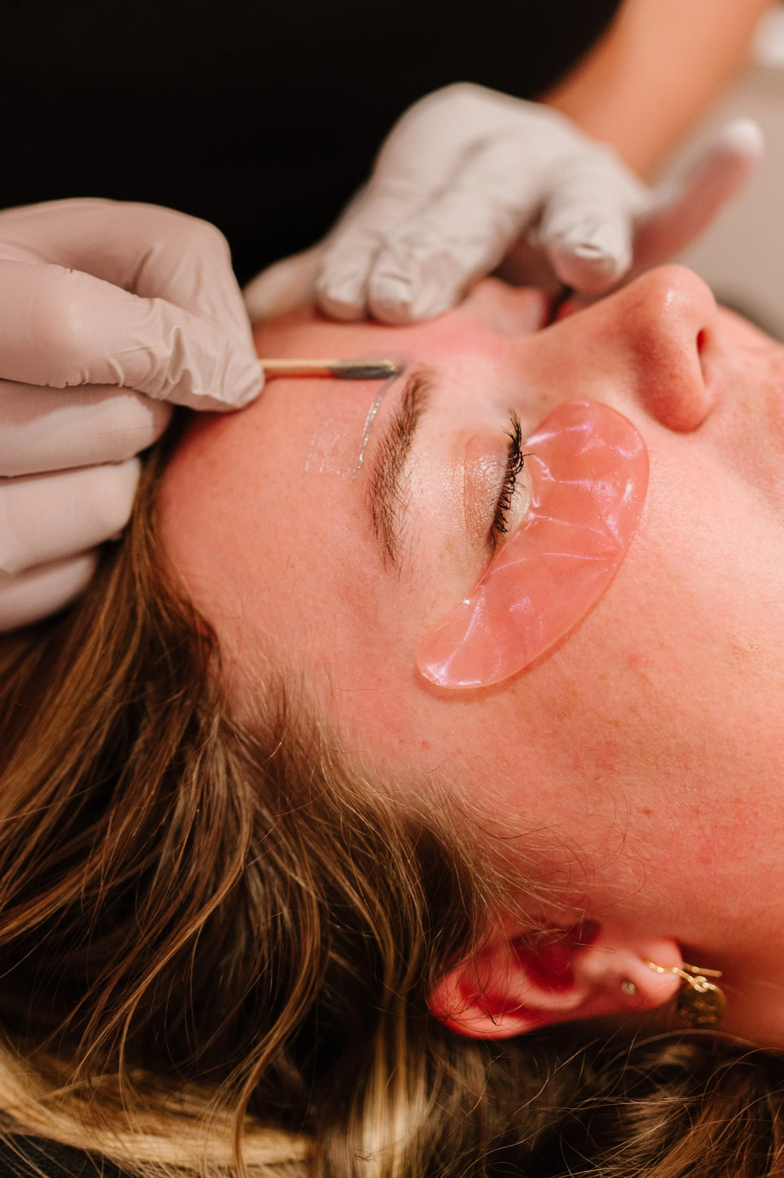 A woman receives a cosmetic facial treatment, with a healthcare professional using a tool near her eyebrow and protected by gloves, lying on her back with a protective eye mask.