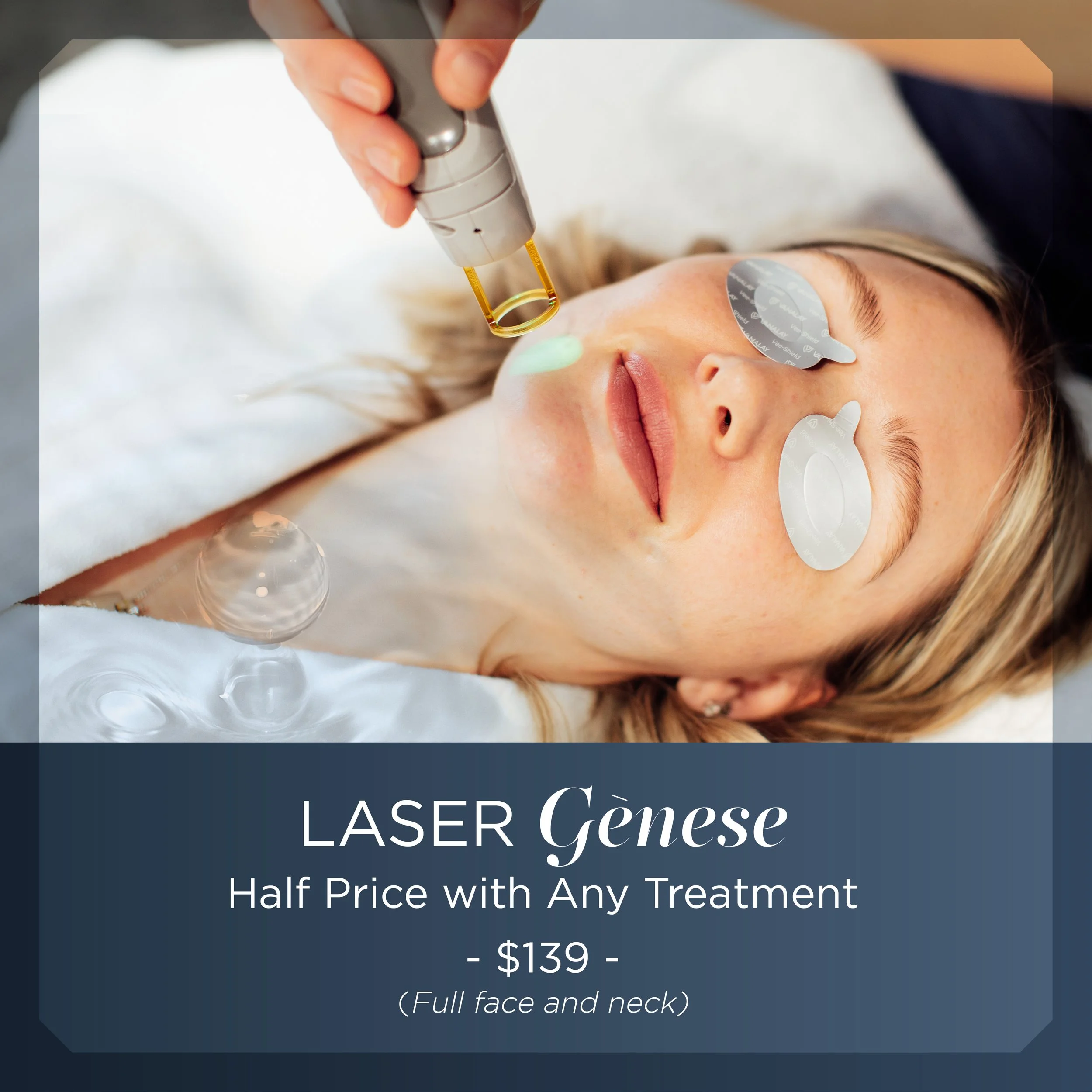 Laser Genese half price