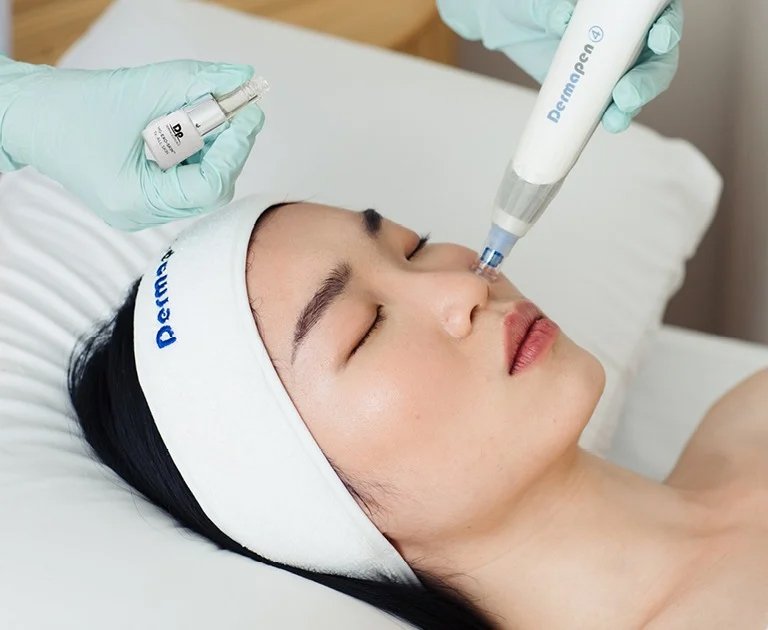 dermapen microneedling with exosomes