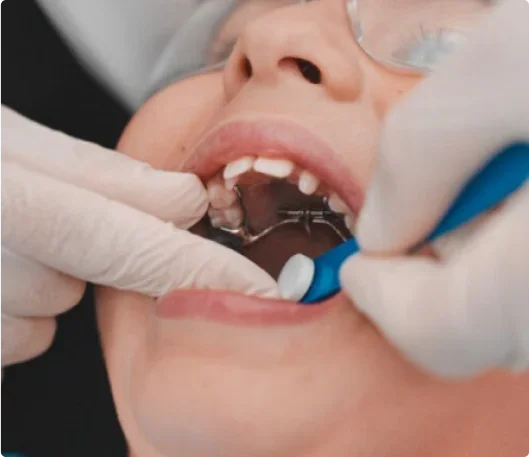 traditional URA.webp