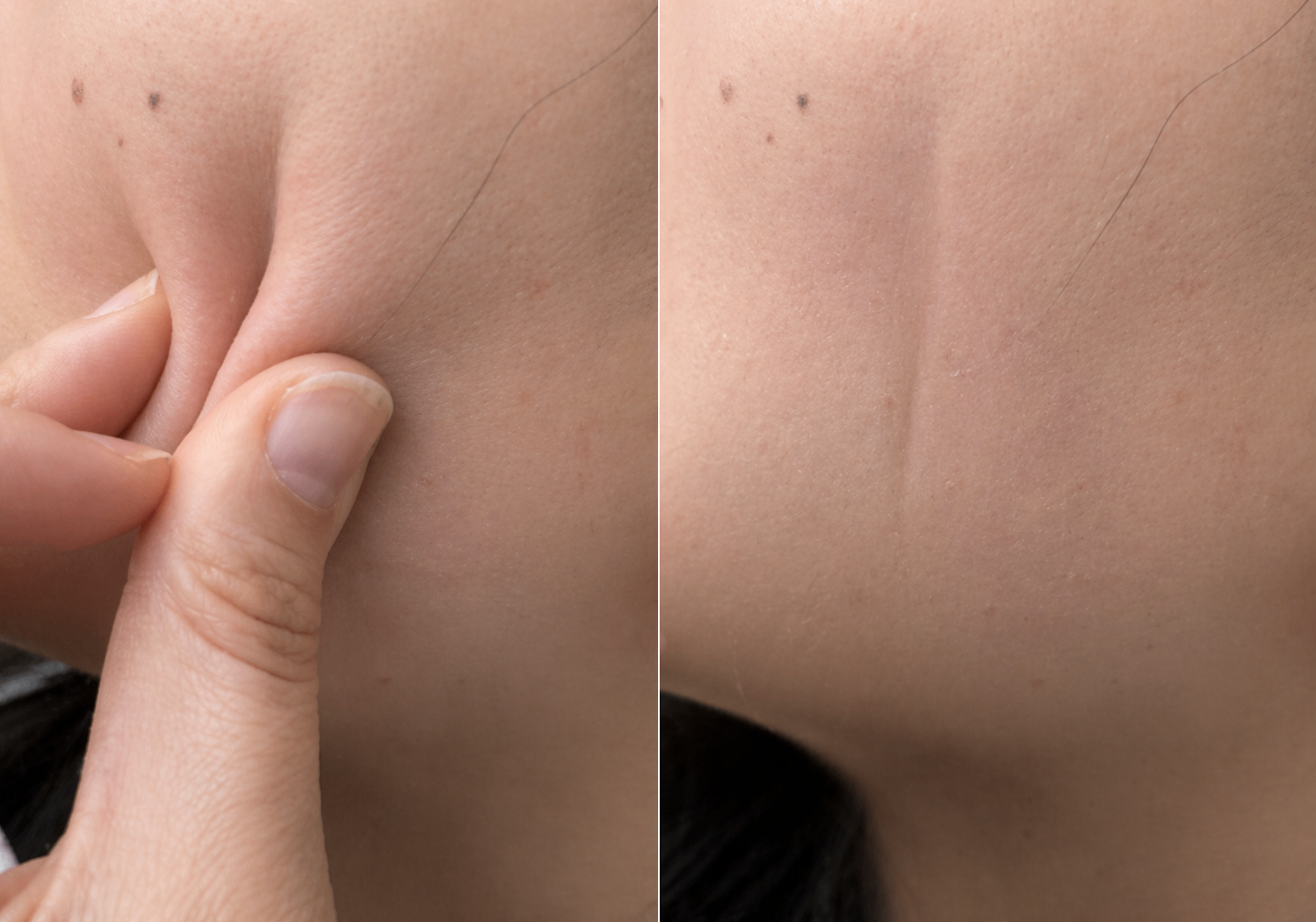 skin dehydration check