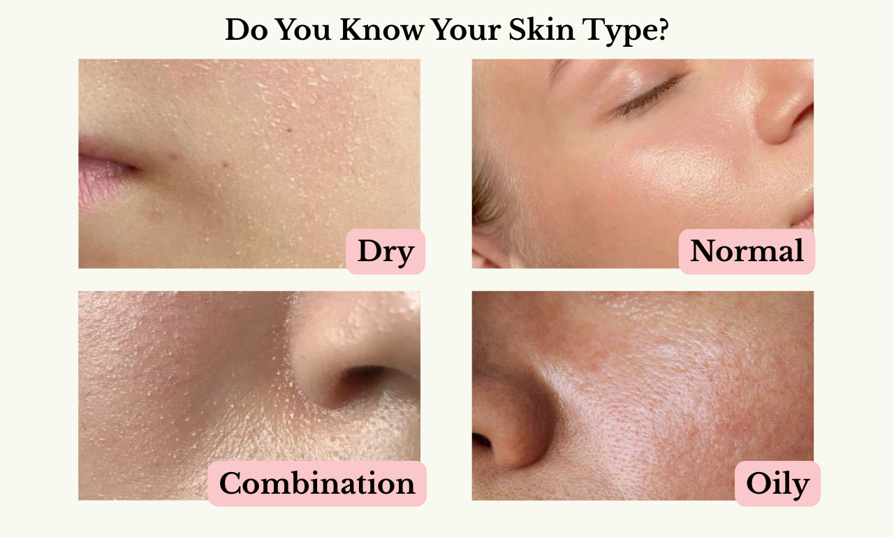 Basic Skin Types
