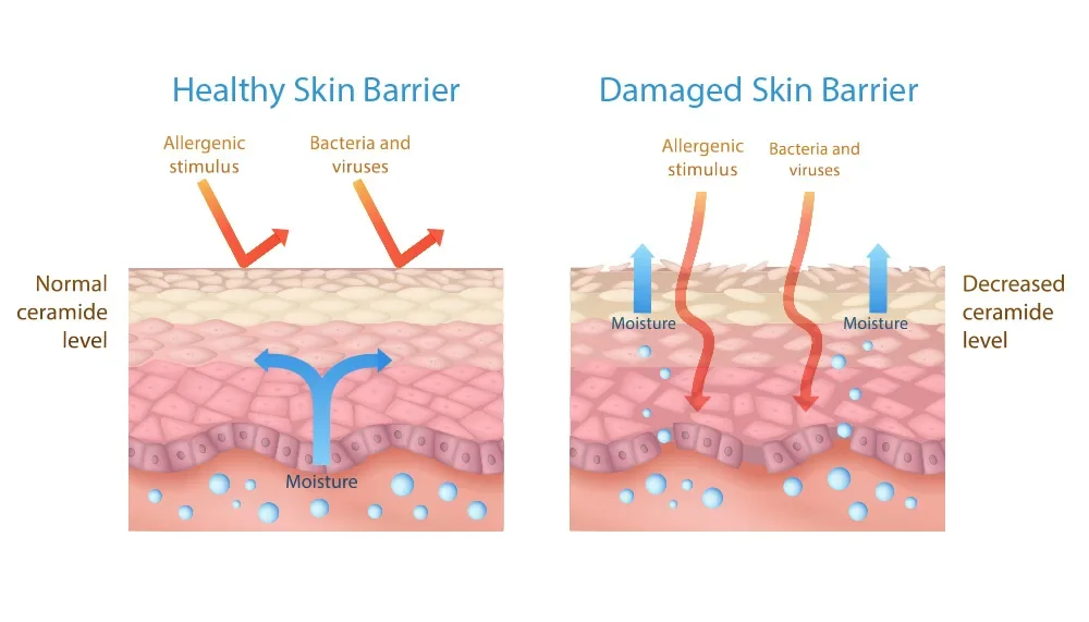 skin barrier