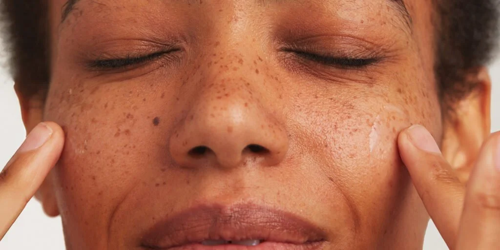 moisturizer for dark spots