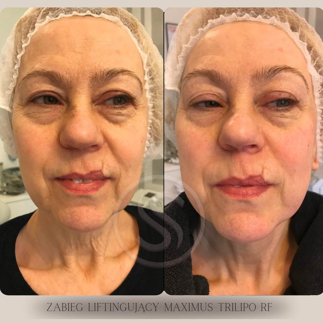 Bez nazwy – kopia 3.PNG