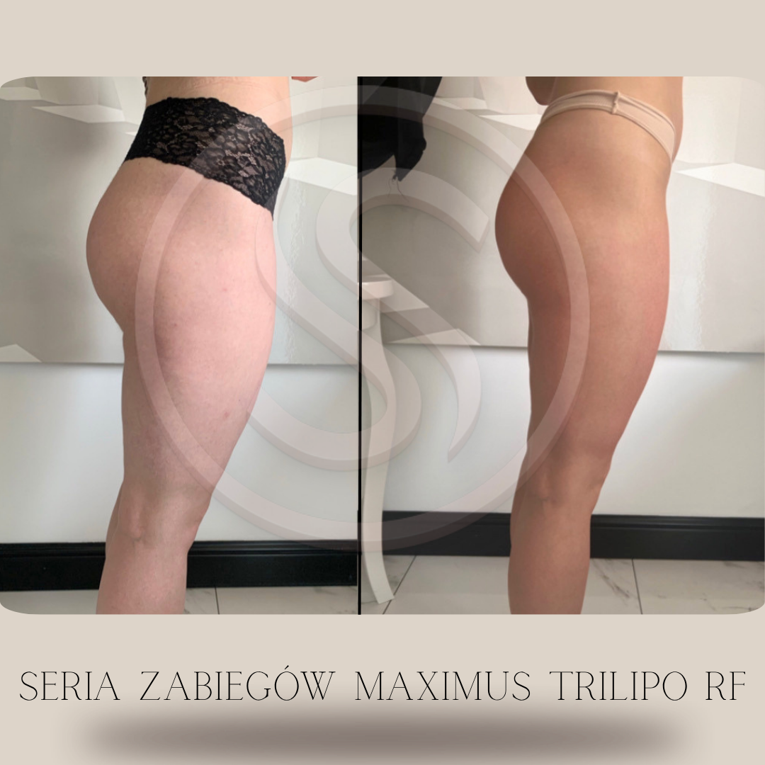 Bez nazwy – kopia 2.PNG